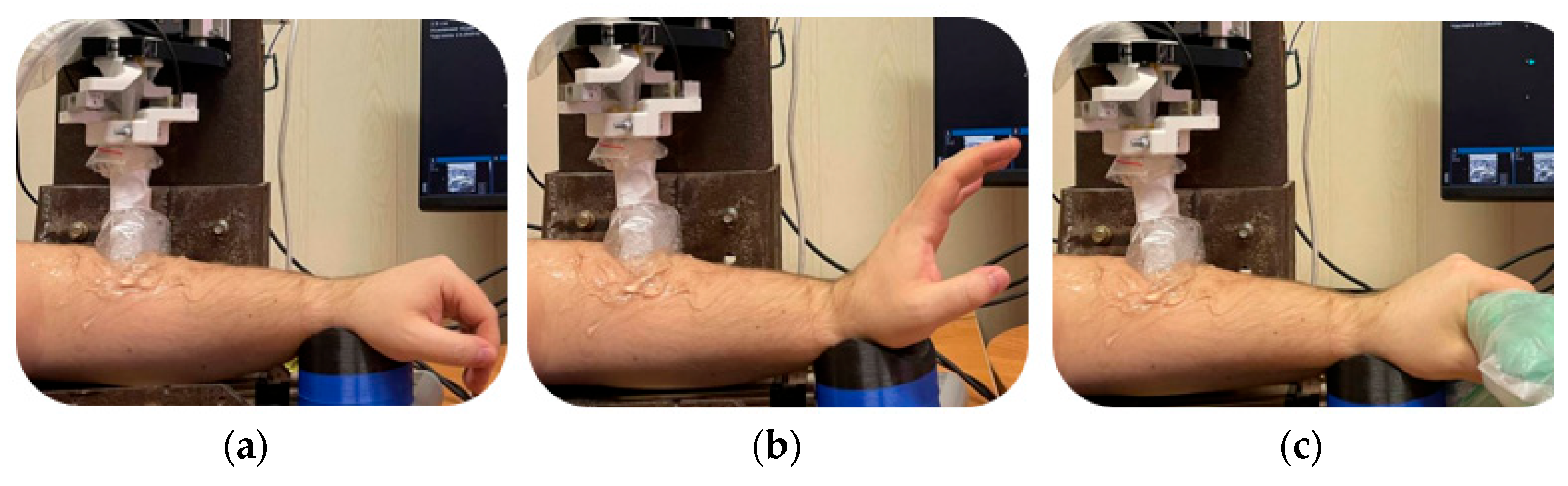 Biosensors 14 00076 g010
