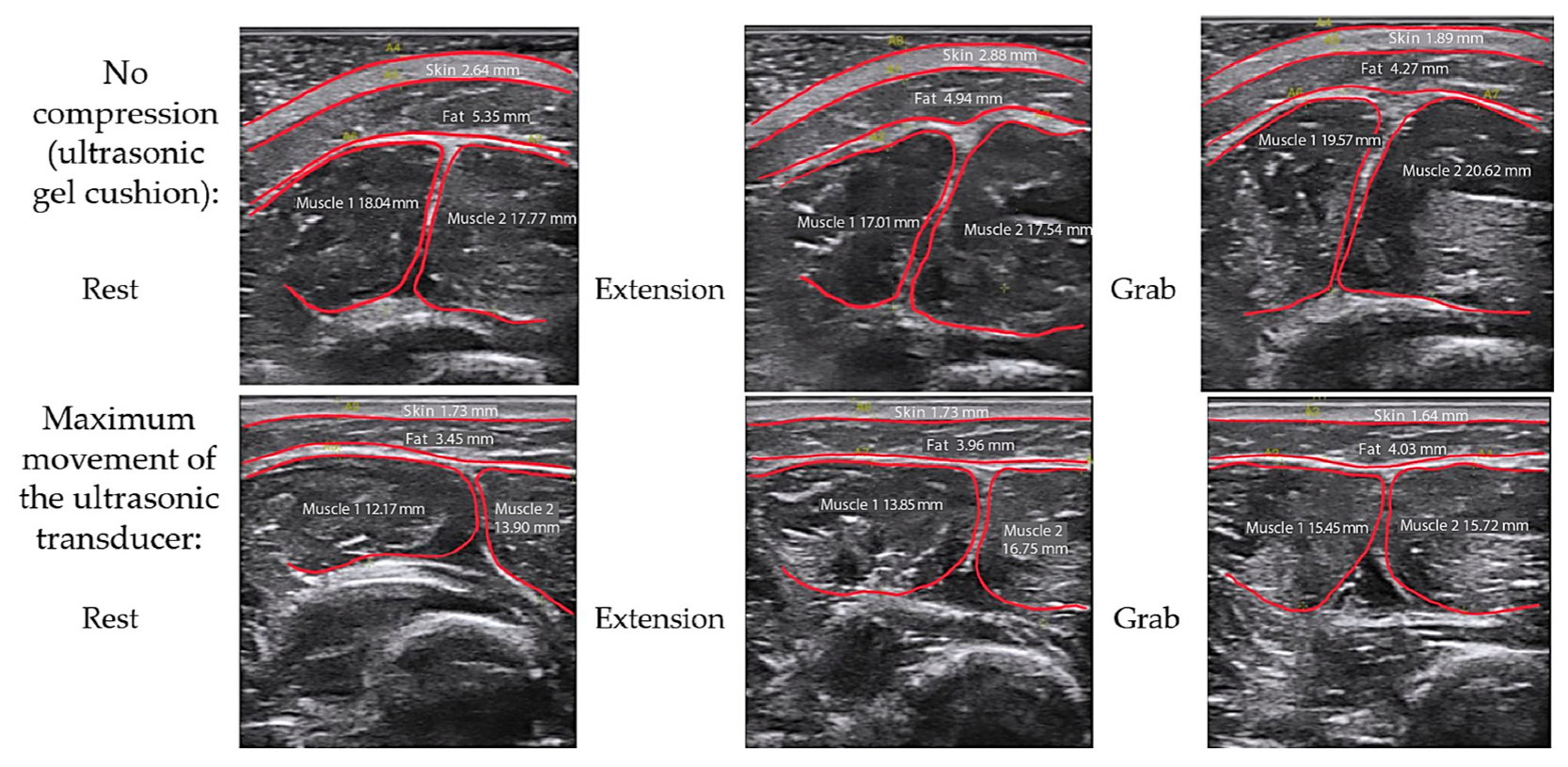 Biosensors 14 00076 g011