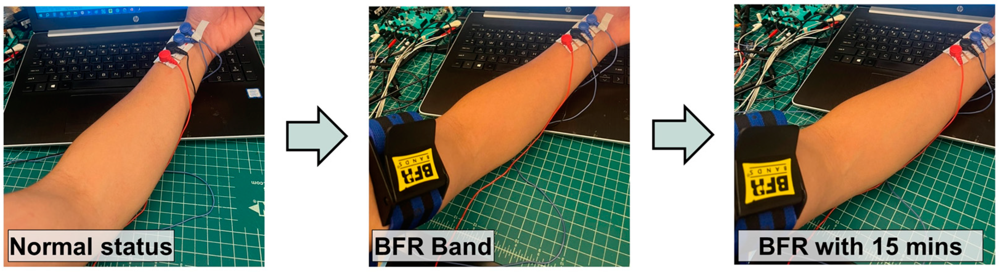 Biosensors 14 00286 g012