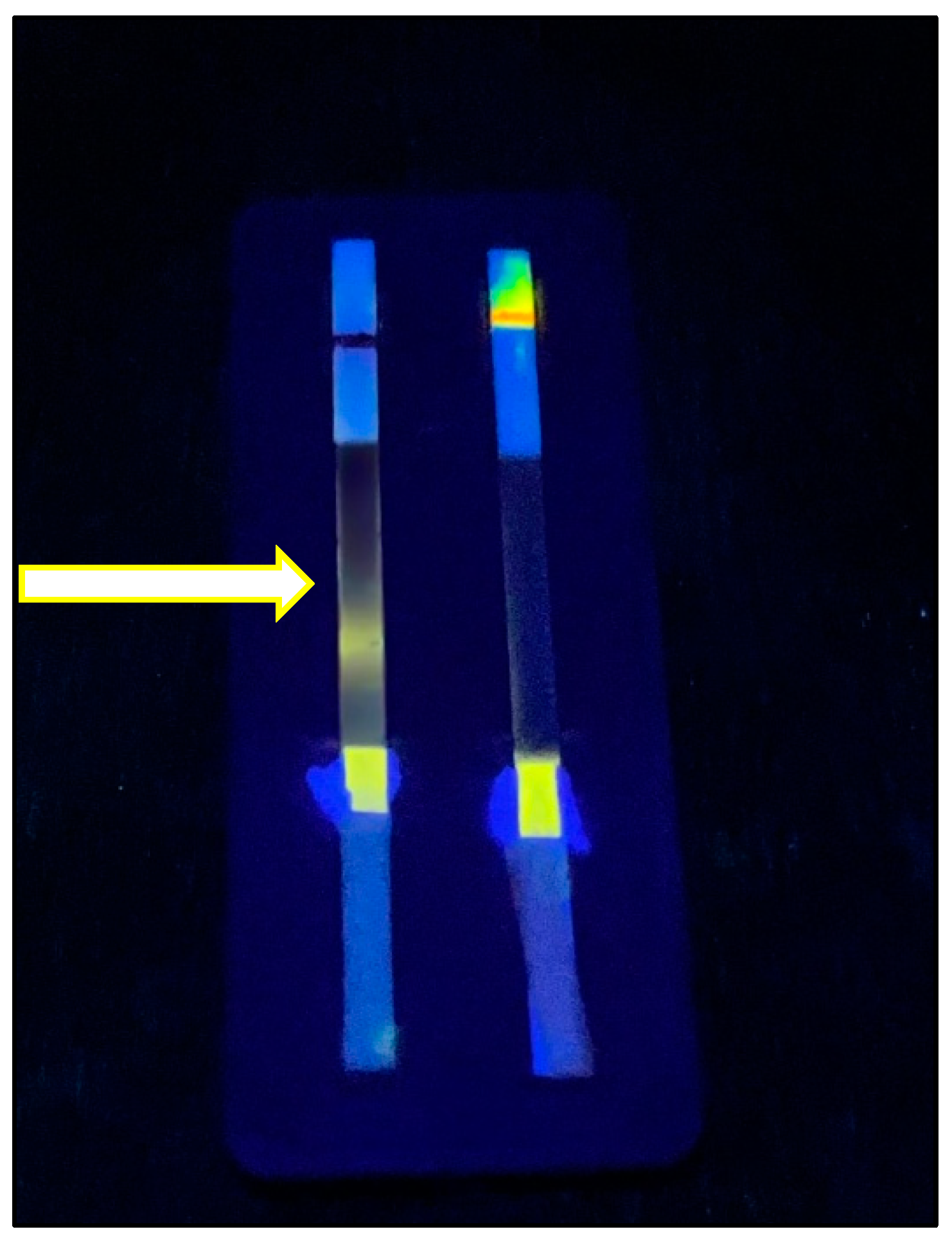Biosensors 15 00256 g011