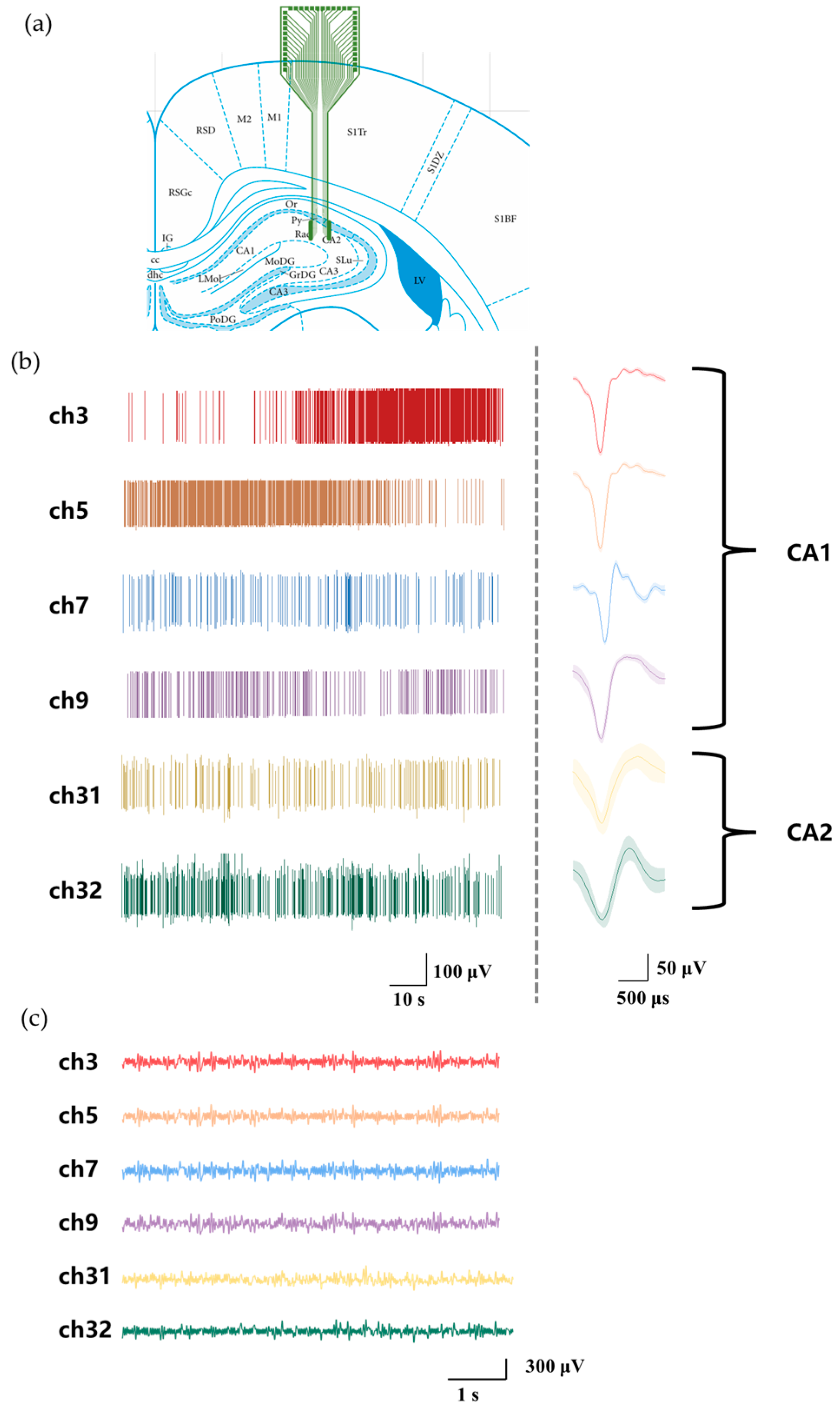Biosensors 15 00262 g006