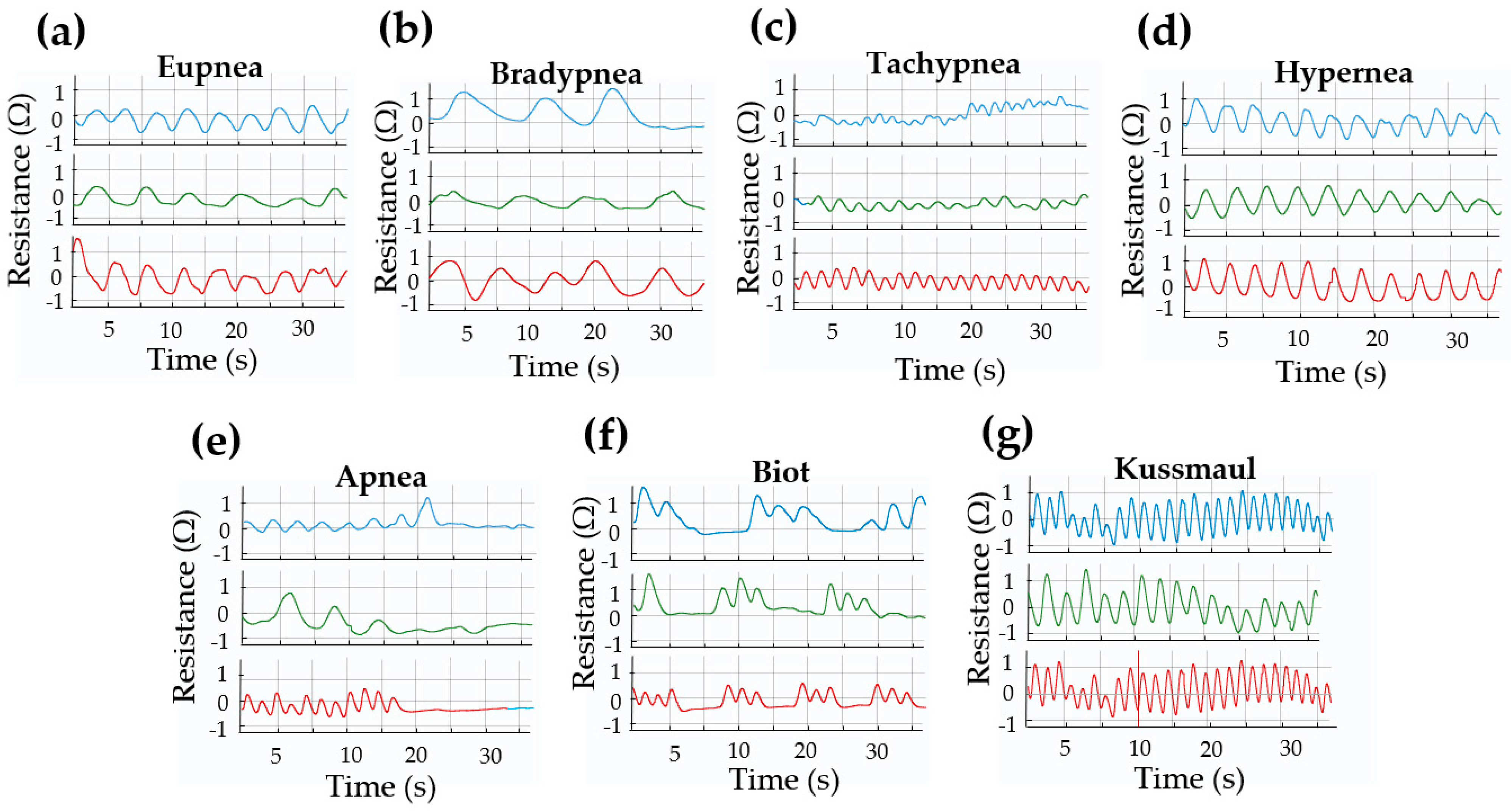 Biosensors 15 00523 g009 Biosensors 15 00523 g009