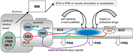 How Spinal Cord Stimulation Works to Manage Pain: David Wu, MD