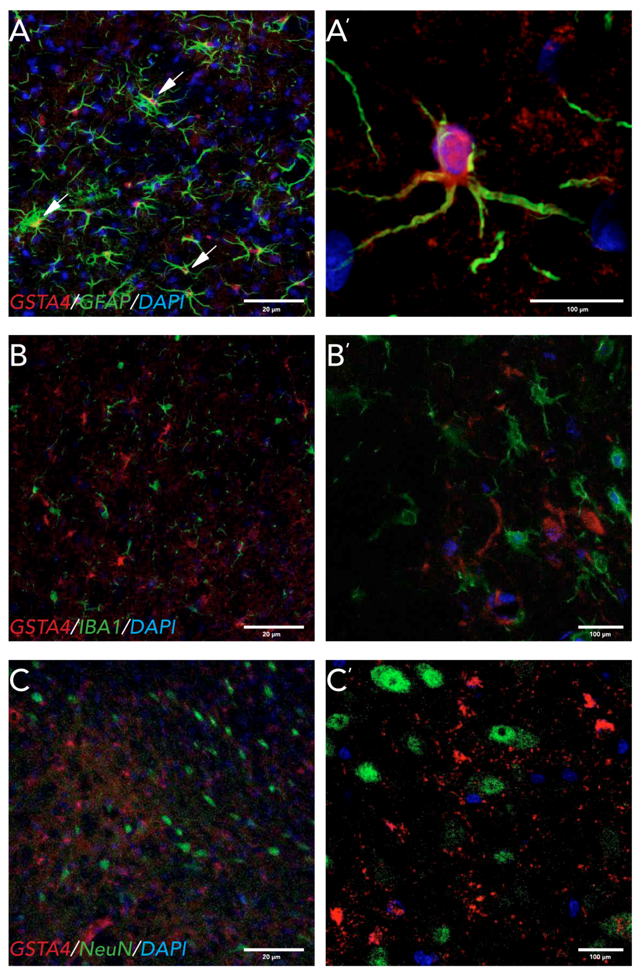 Brain Sciences | Free Full-Text | Astrocytic Expression of GSTA4 ...