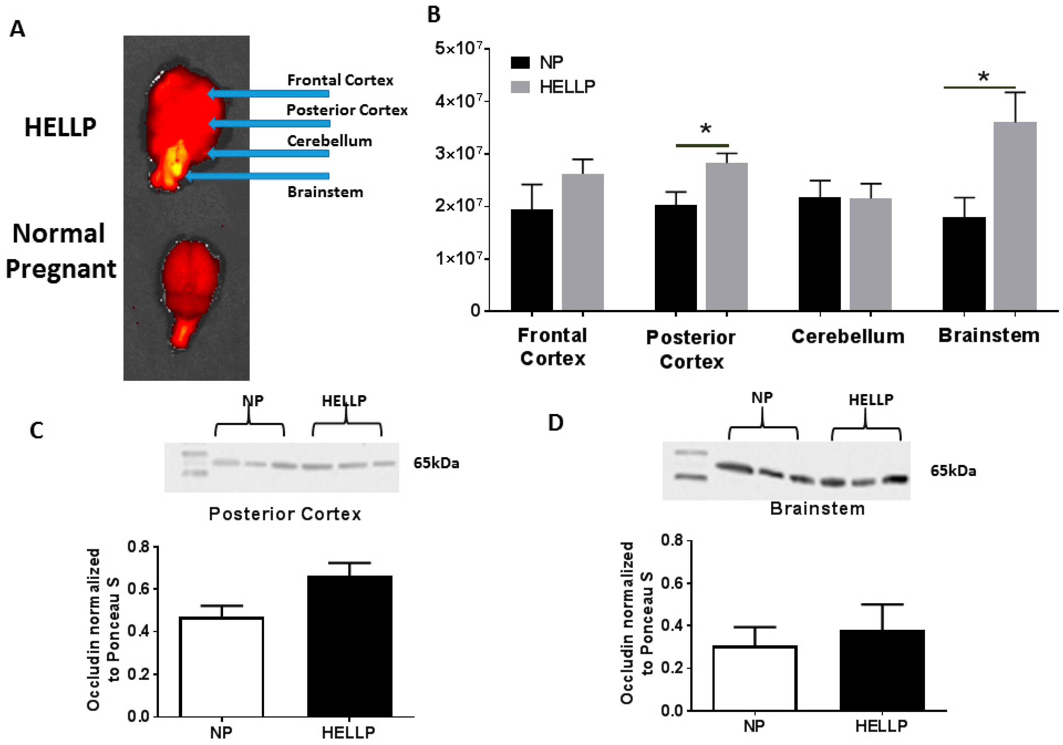 Brainsci 08 00216 g003 Brainsci 08 00216 g003