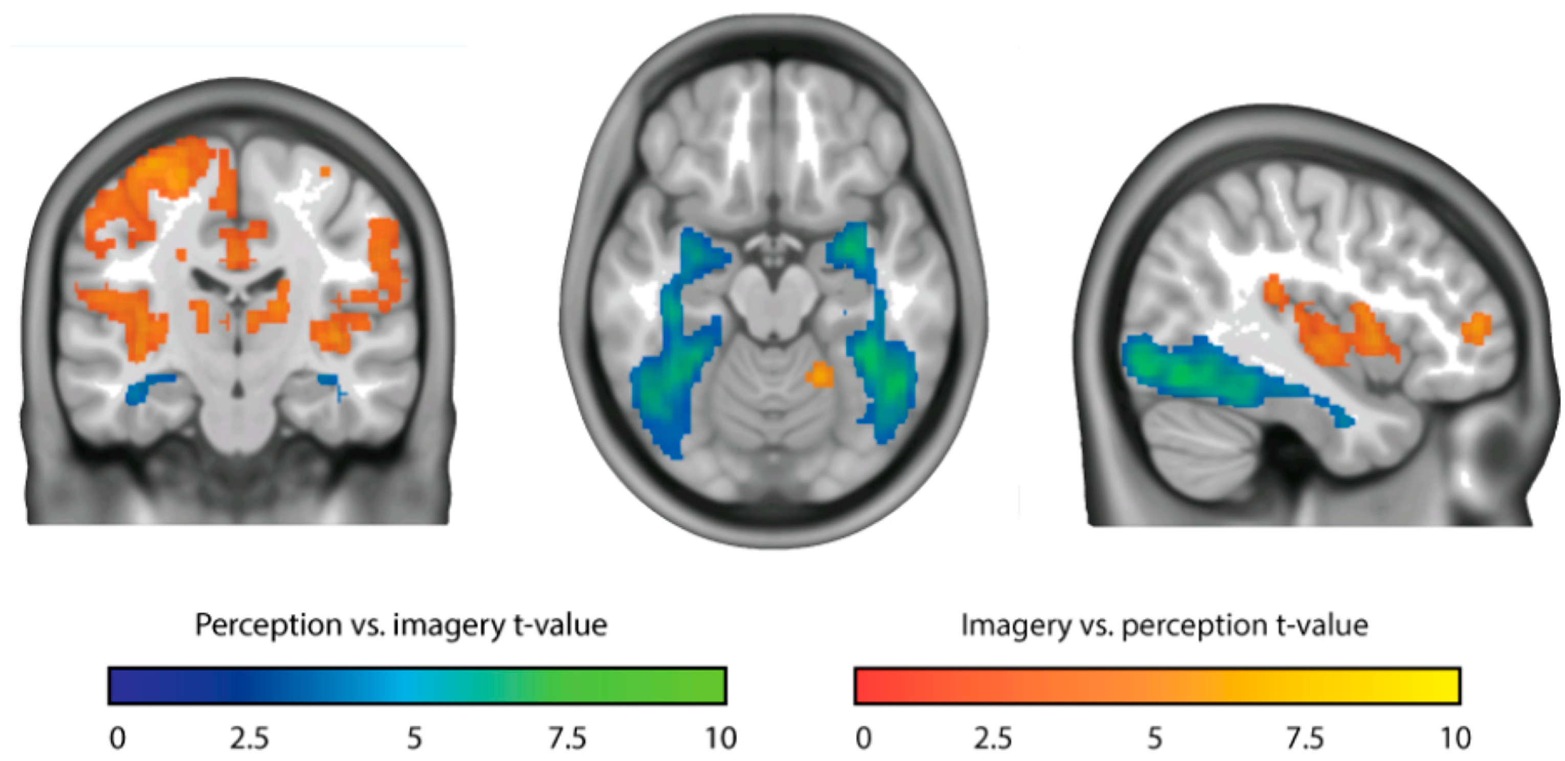 [PDF] Alzheimers the infinite mind vol 65