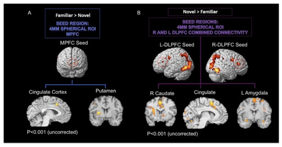 Brain Sciences Free Full Text Common And Distinct Functional Brain Networks For Intuitive And Deliberate Decision Making Html