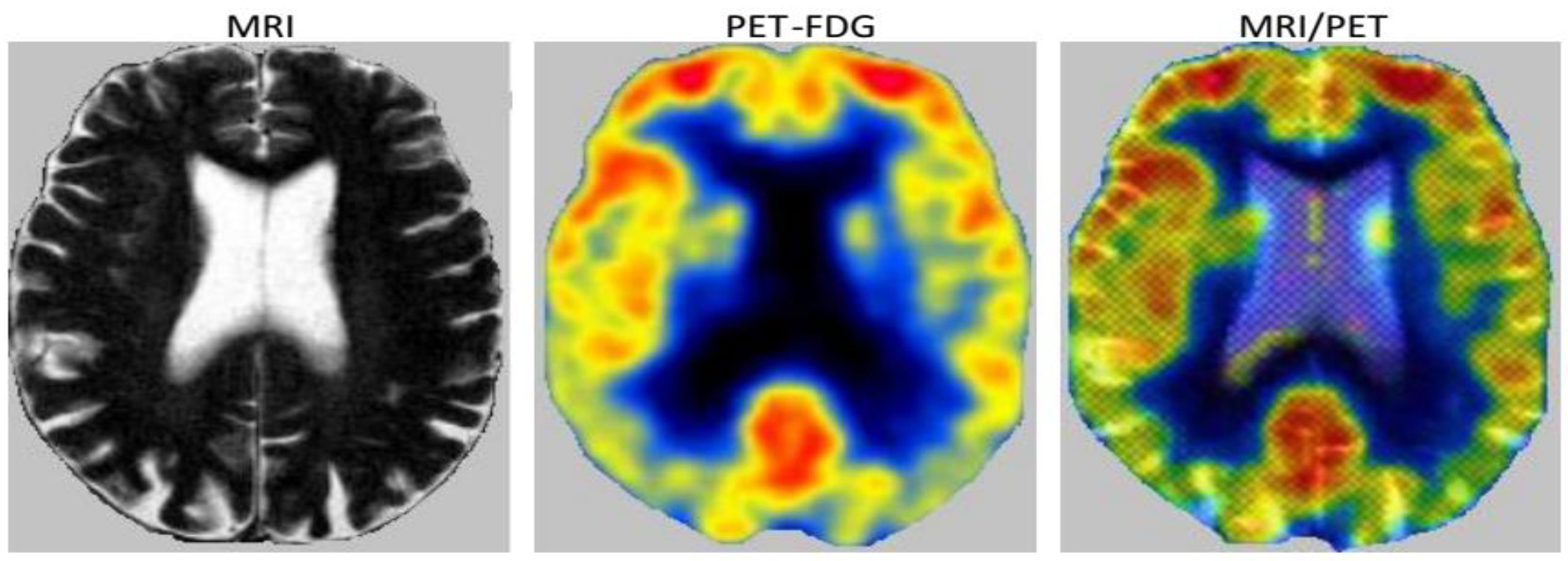 Brainsci 09 00289 g005 Brainsci 09 00289 g005