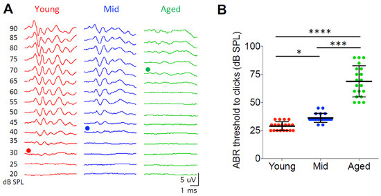 Otolaryngology: Open Access - Mapping Auditory Maturation from Neonates to  Toddlers using Electrophysiological Responses of the Brainstem