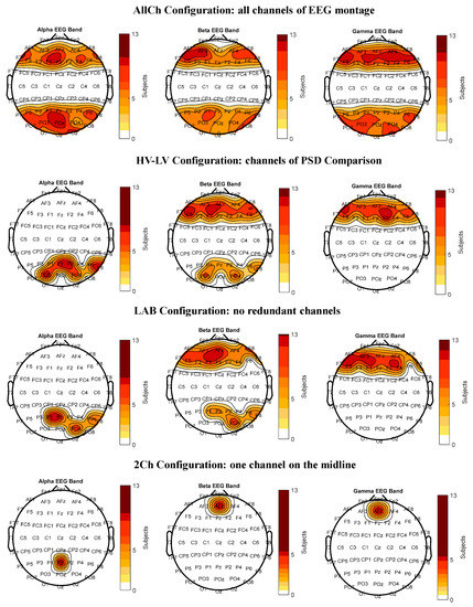 Brain Sciences Special Issue Brain Plasticity Cognitive Training And Mental States Assessment