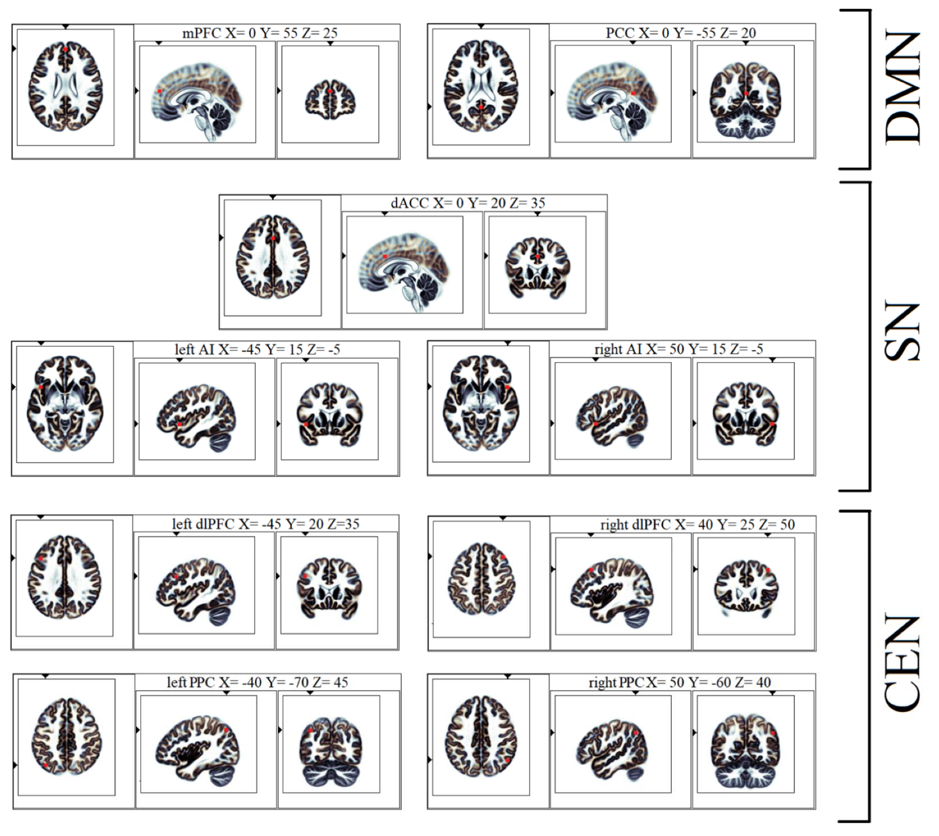 Brain Sciences Free Full Text Increased Resting State Triple Network Functional Connectivity In Undergraduate Problematic Cannabis Users A Preliminary Eeg Coherence Study Html