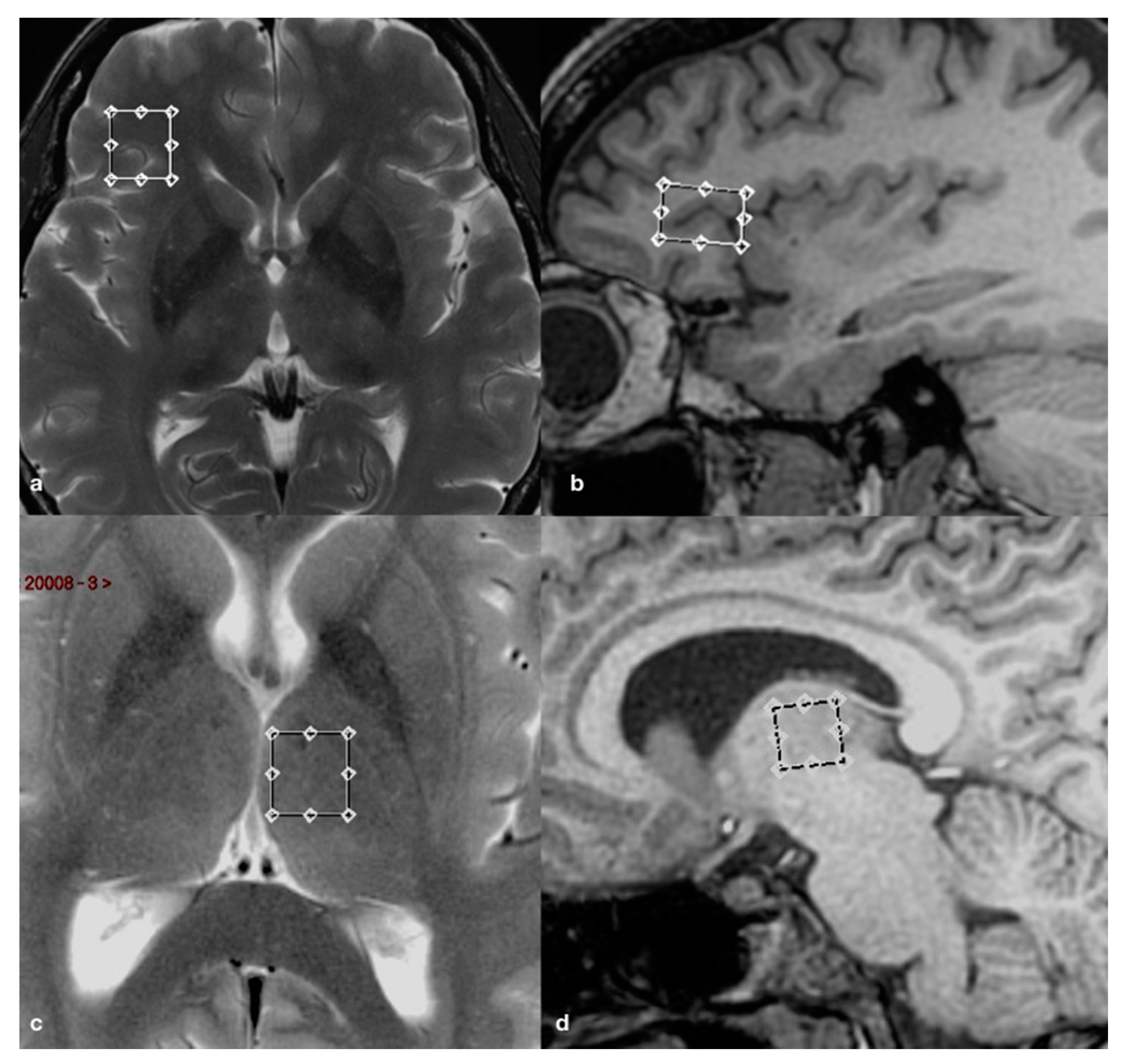 Brainsci 10 00395 g001 Brainsci 10 00395 g001