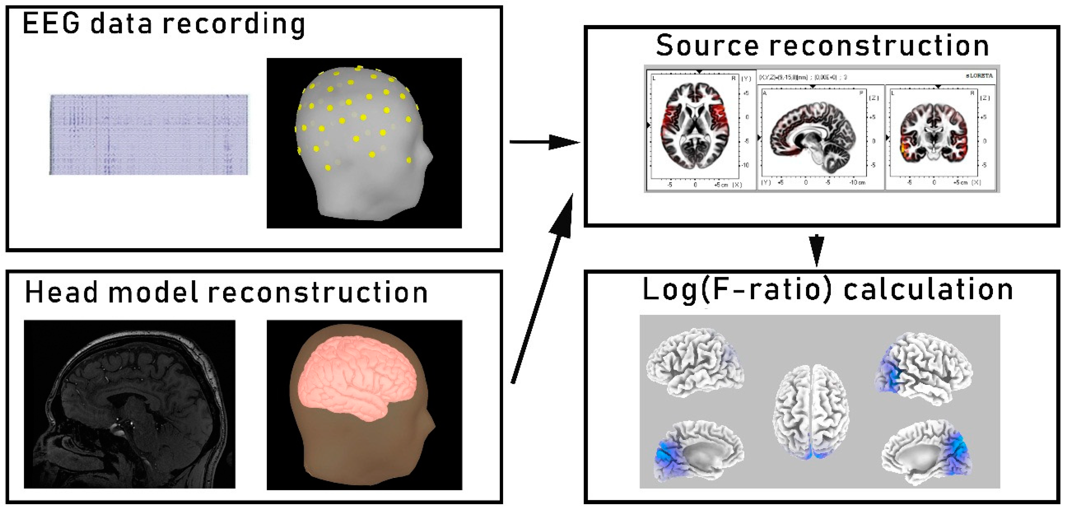 Brain Sciences | Free Full-Text | Widespread Reductions of Spontaneous