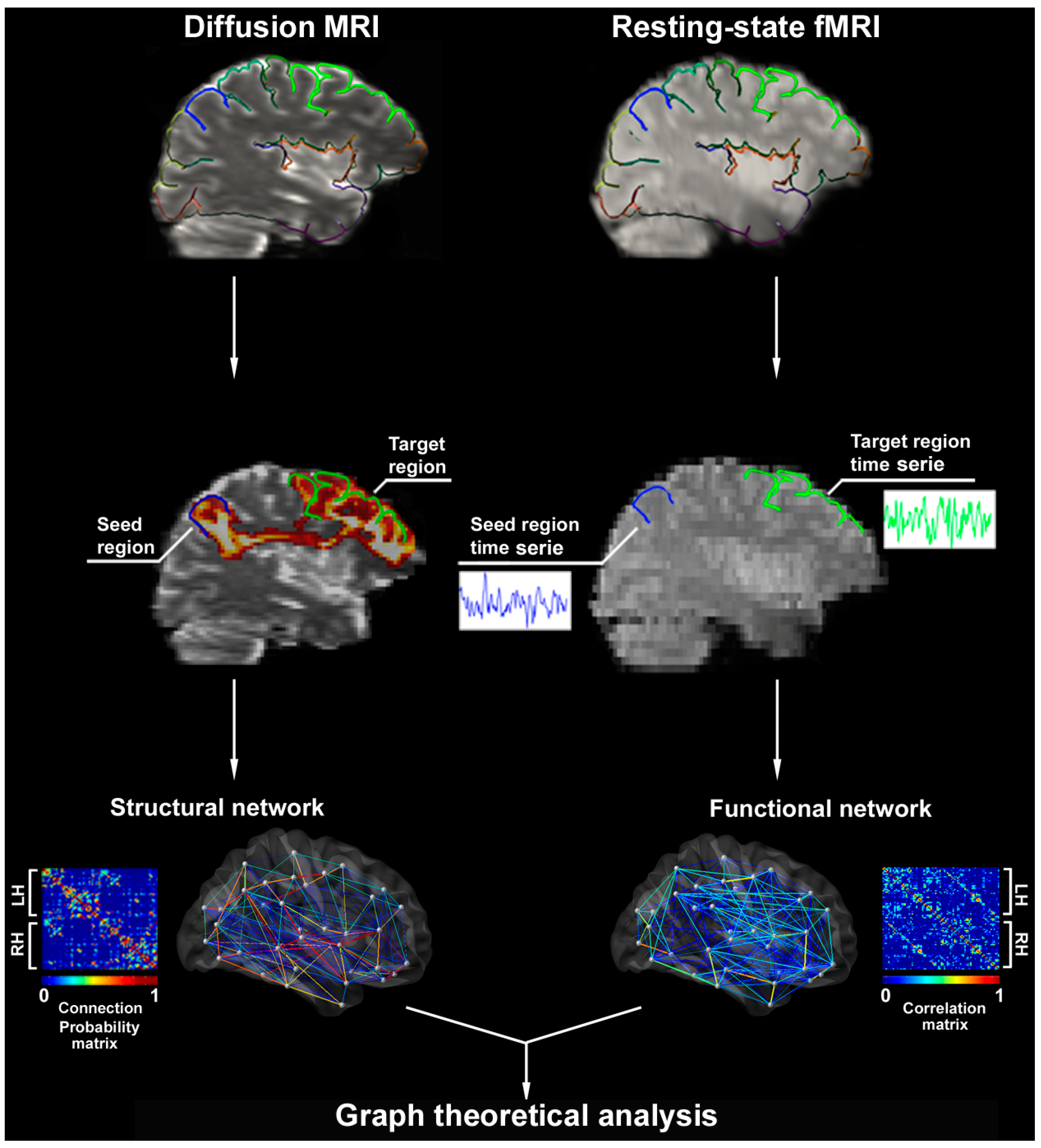 Brain Sciences Free Full Text Contributions Of Imaging To Neuromodulatory Treatment Of Drug Refractory Epilepsy Html
