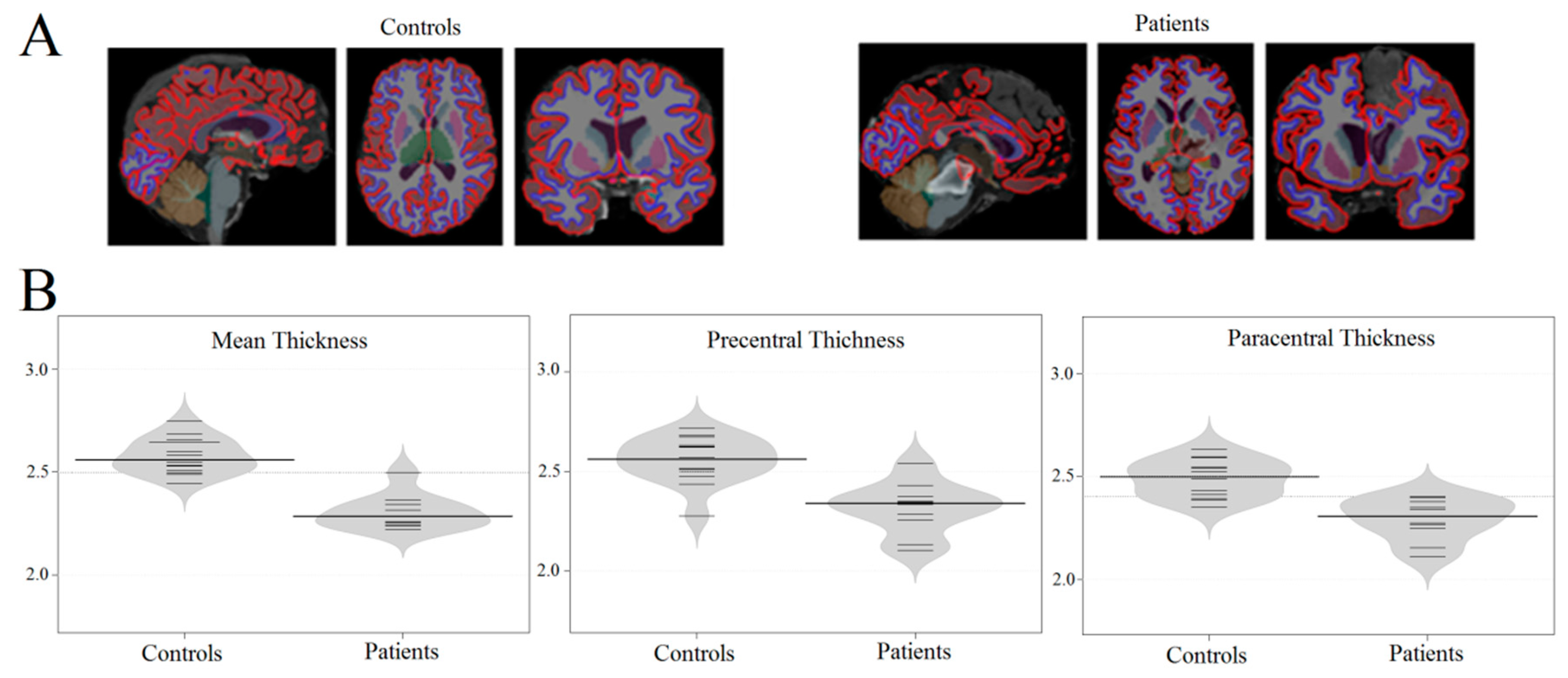 Brainsci 10 00720 g001