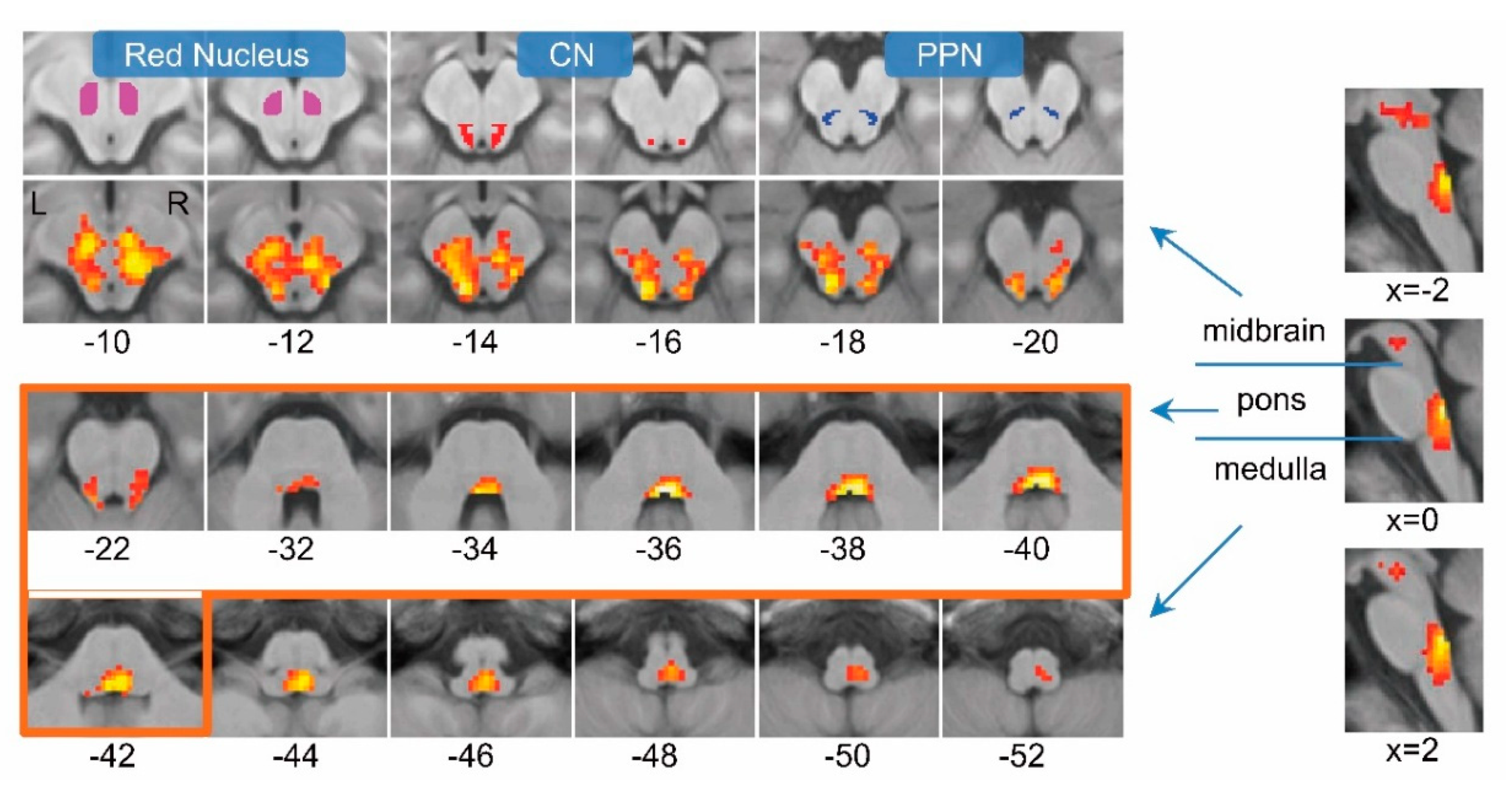 Brain Sciences | Free Full-Text | Functional MRI Reveals Locomotion-Control  Neural Circuits in Human Brainstem