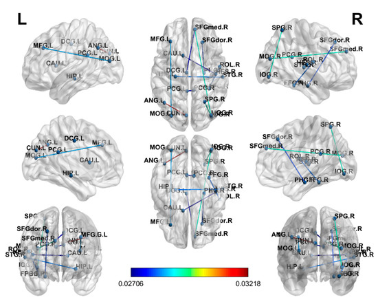 Brain Sciences Free Full Text Functional And Structural Connectome Features For Machine Learning Chemo Brain Prediction In Women Treated For Breast Cancer With Chemotherapy Html