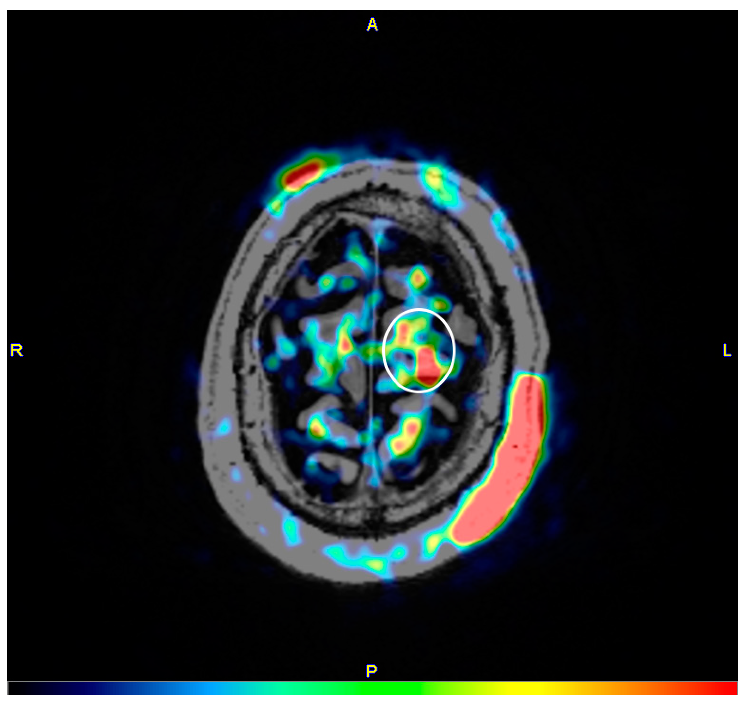 Brainsci 10 00855 g004