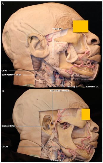 lymph nodes base of skull