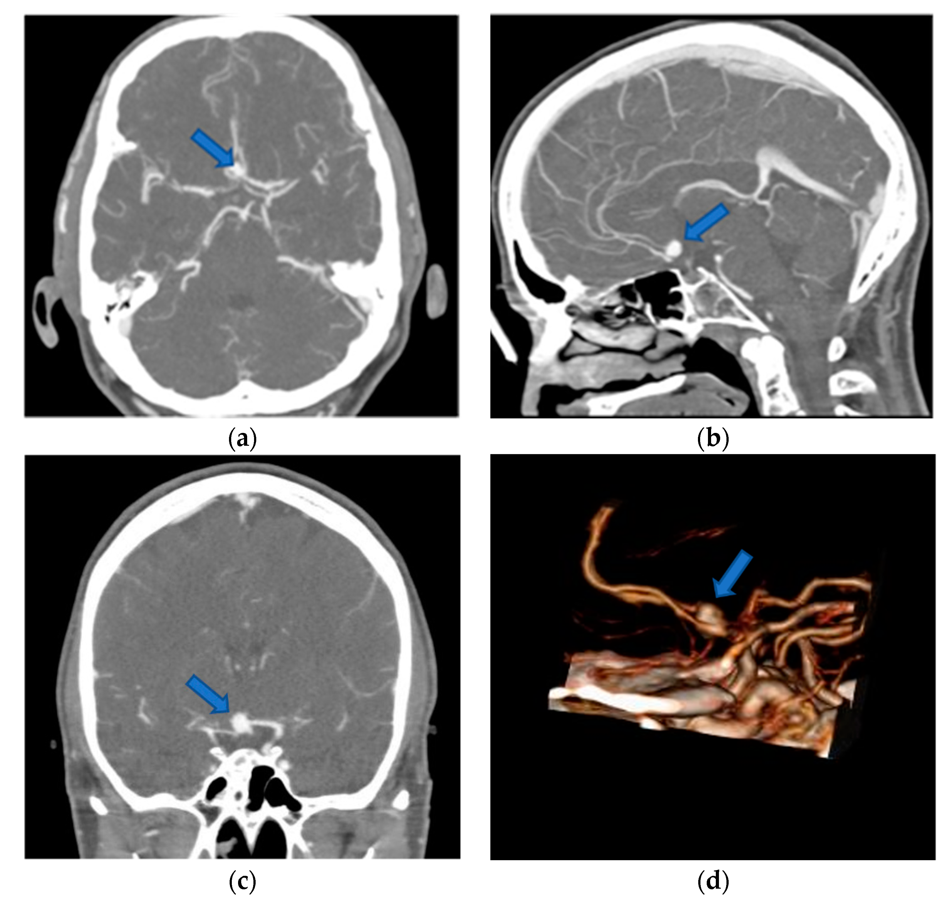 Brainsci 10 00963 g002 Brainsci 10 00963 g002