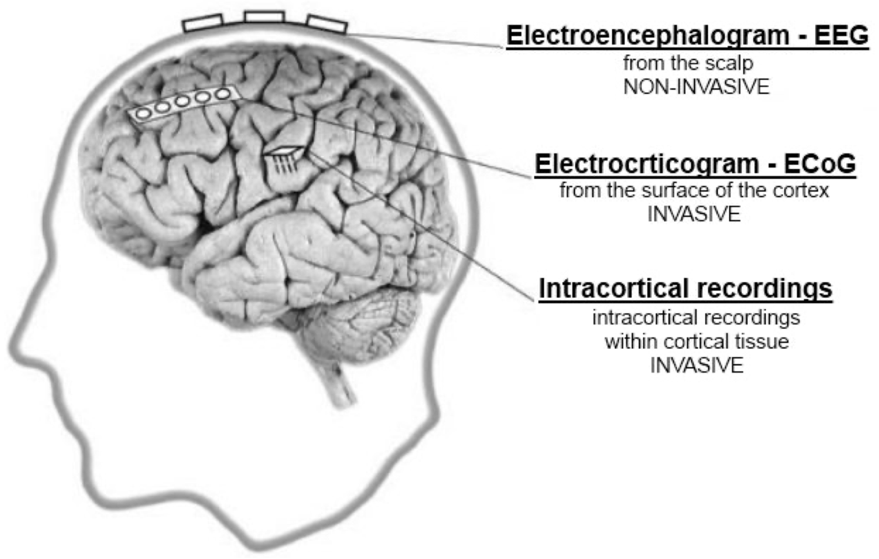Brain Sciences | Free Full-Text | Summary of over Fifty Years with Brain-Computer  Interfaces—A Review | HTML