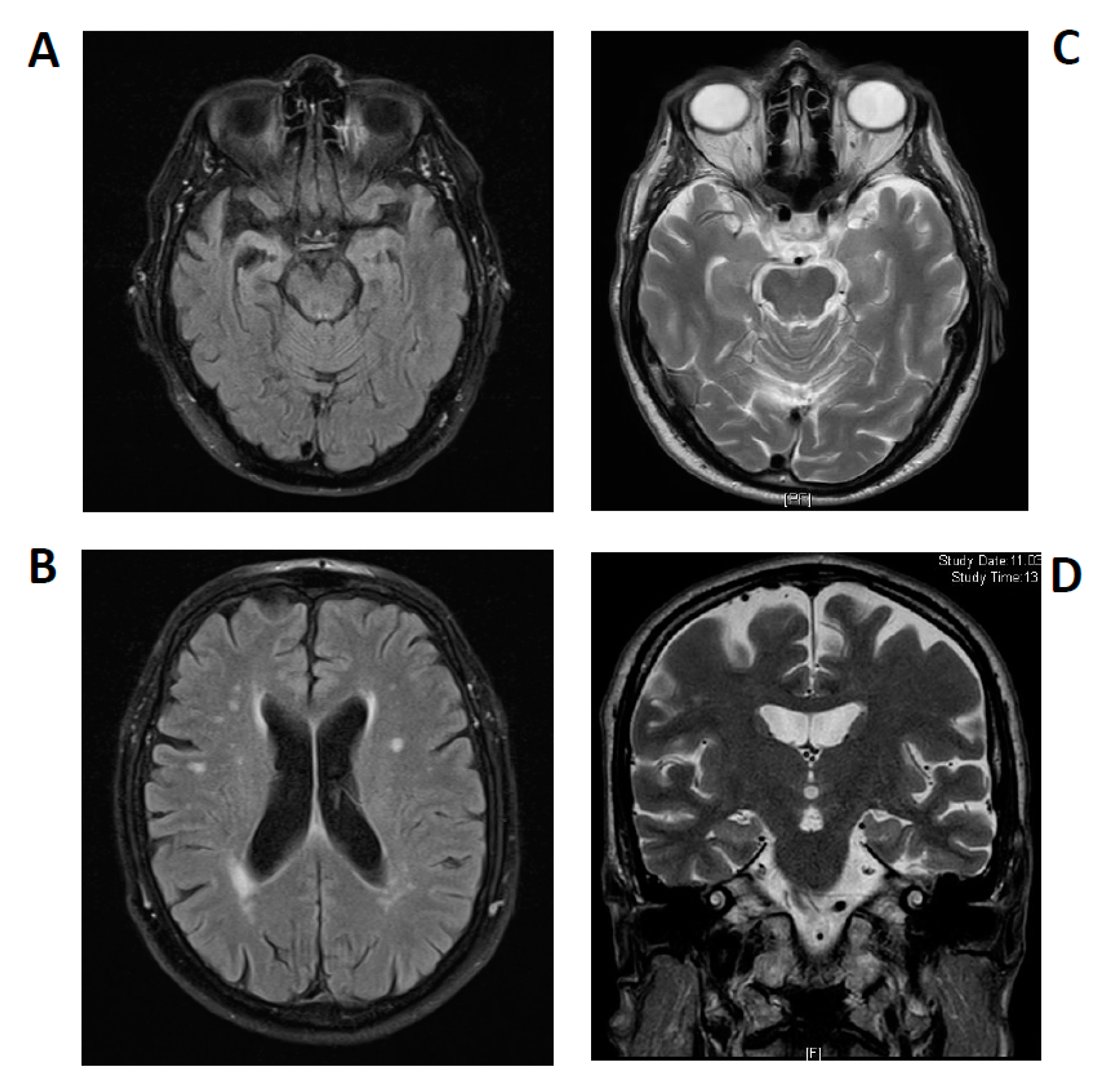 Brainsci 11 00089 g002