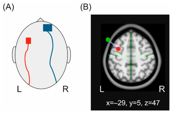 Brain Sciences | Free Full-Text | Cathodal Transcranial Direct Current  Stimulation (tDCS) Applied to the Left Premotor Cortex Interferes with  Explicit Reproduction of a Motor Sequence