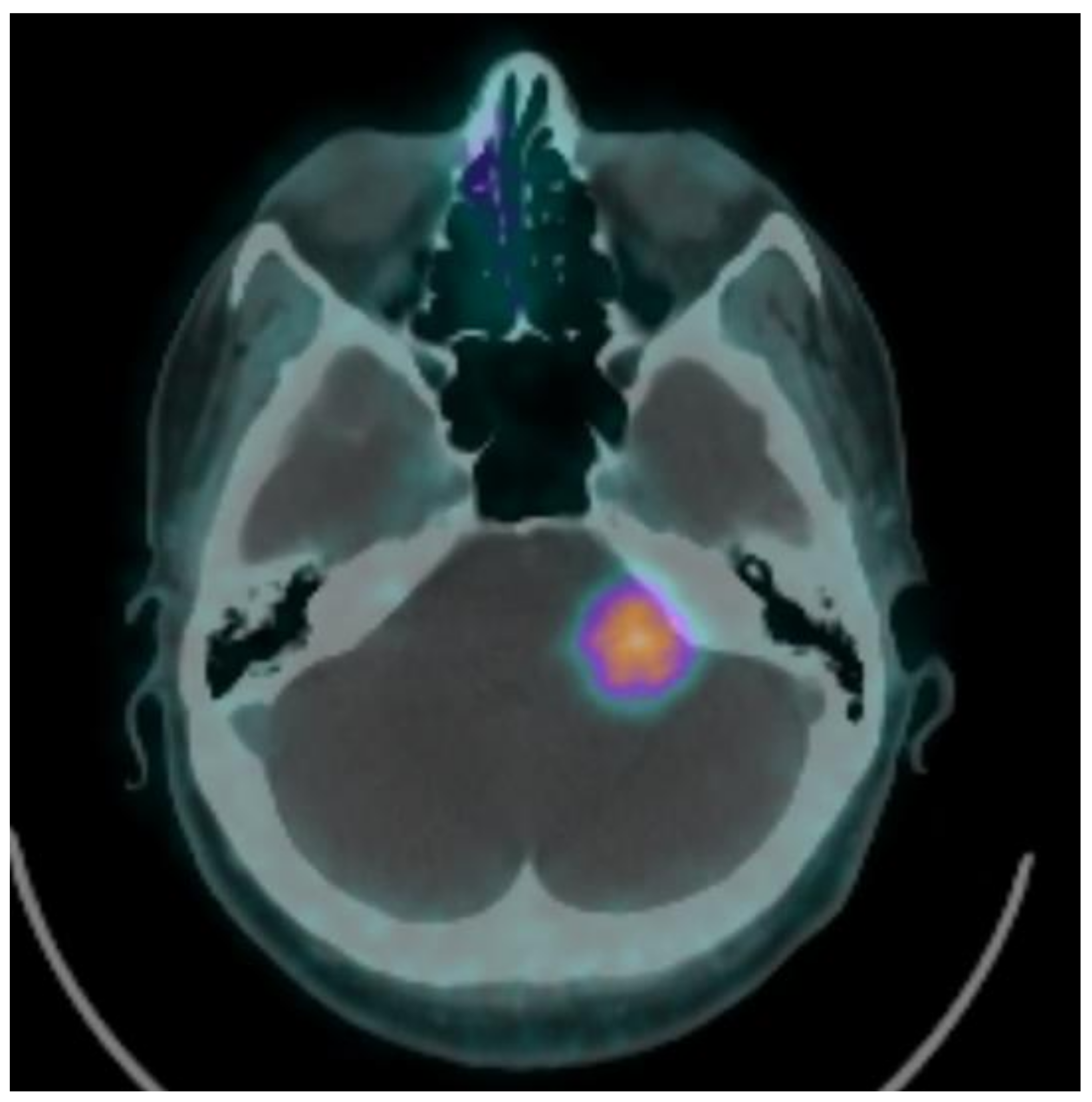 Brainsci 11 00375 g001 Brainsci 11 00375 g001