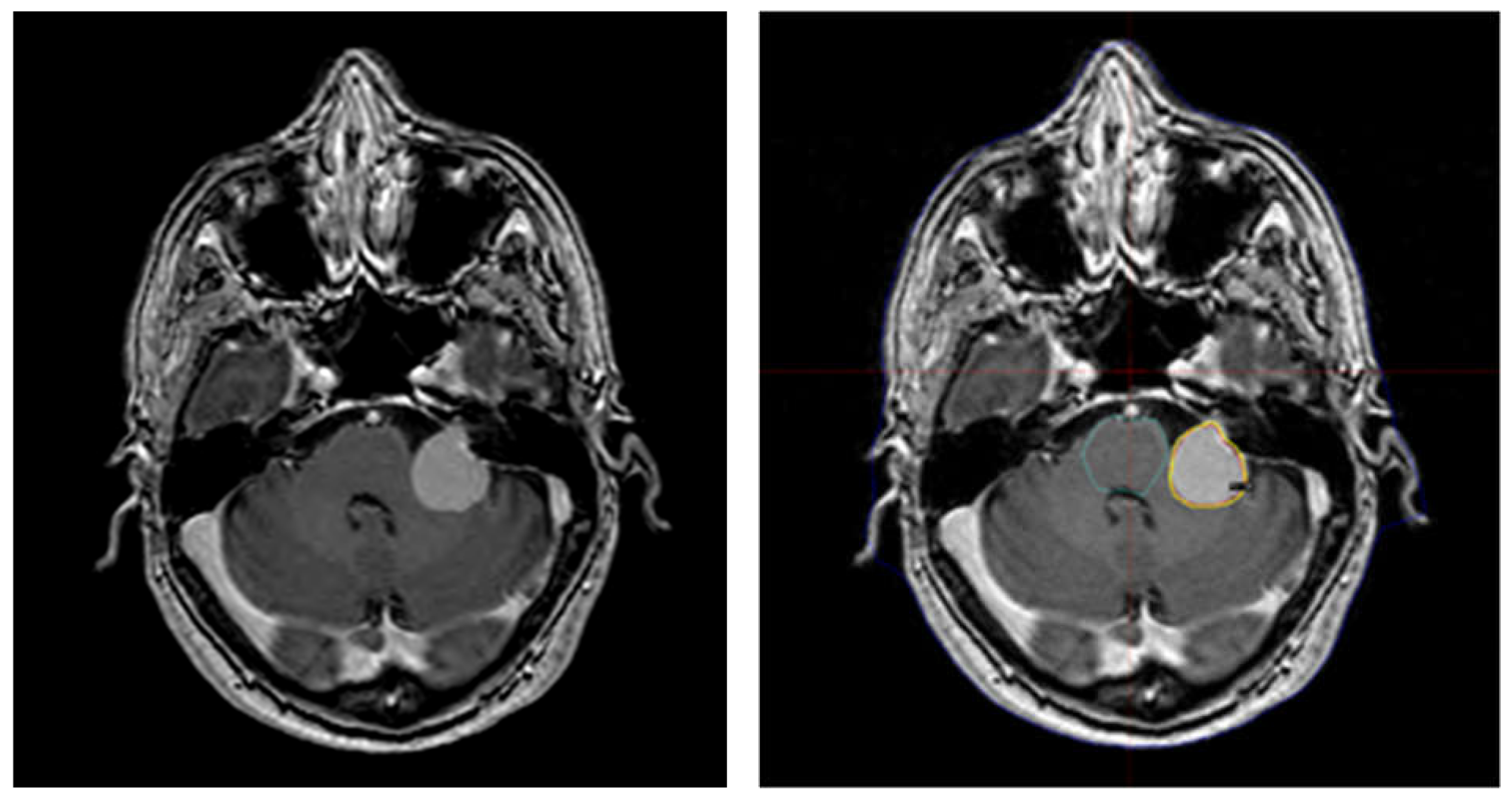 Brainsci 11 00375 g002 Brainsci 11 00375 g002