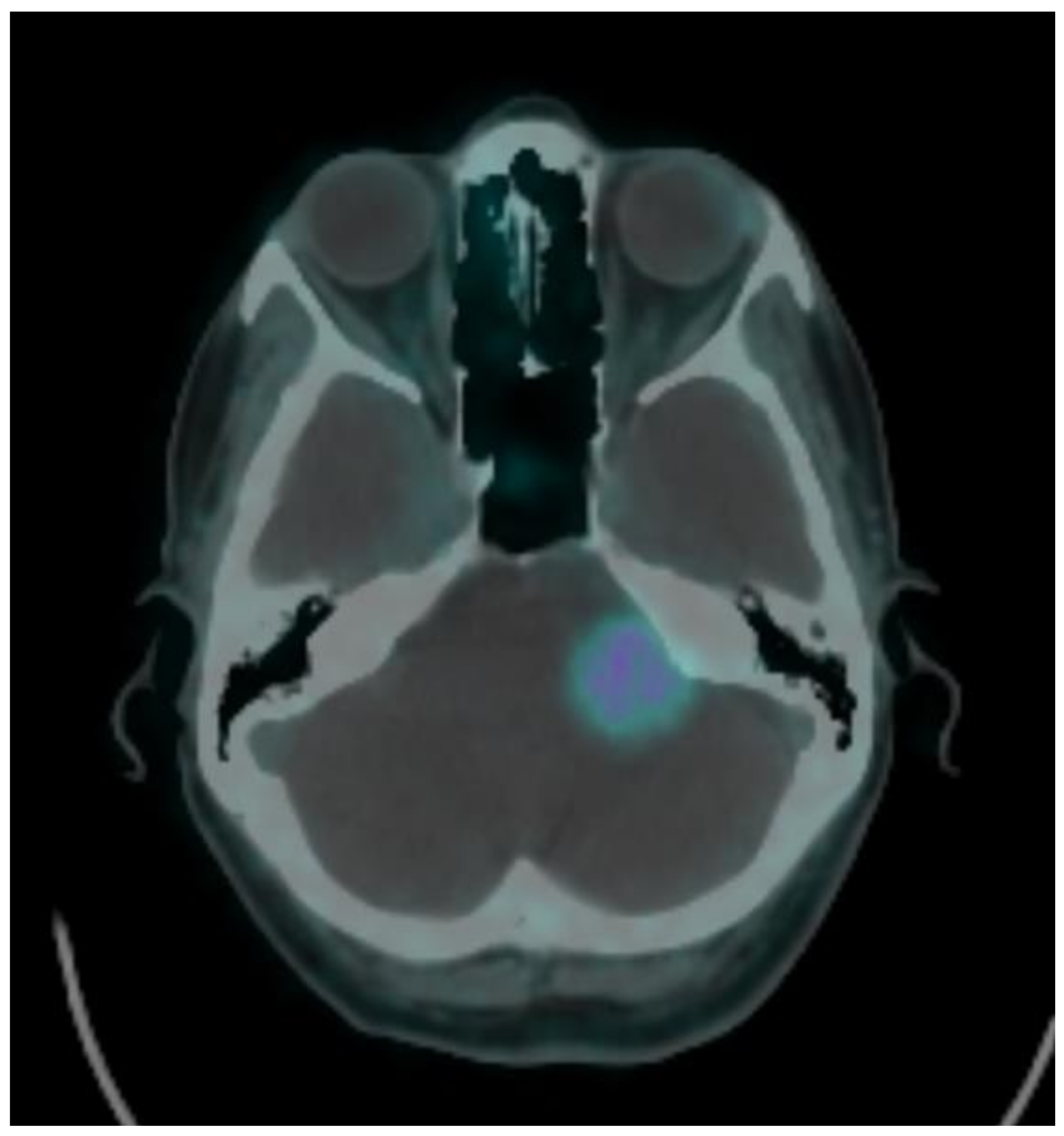 Brainsci 11 00375 g003 Brainsci 11 00375 g003