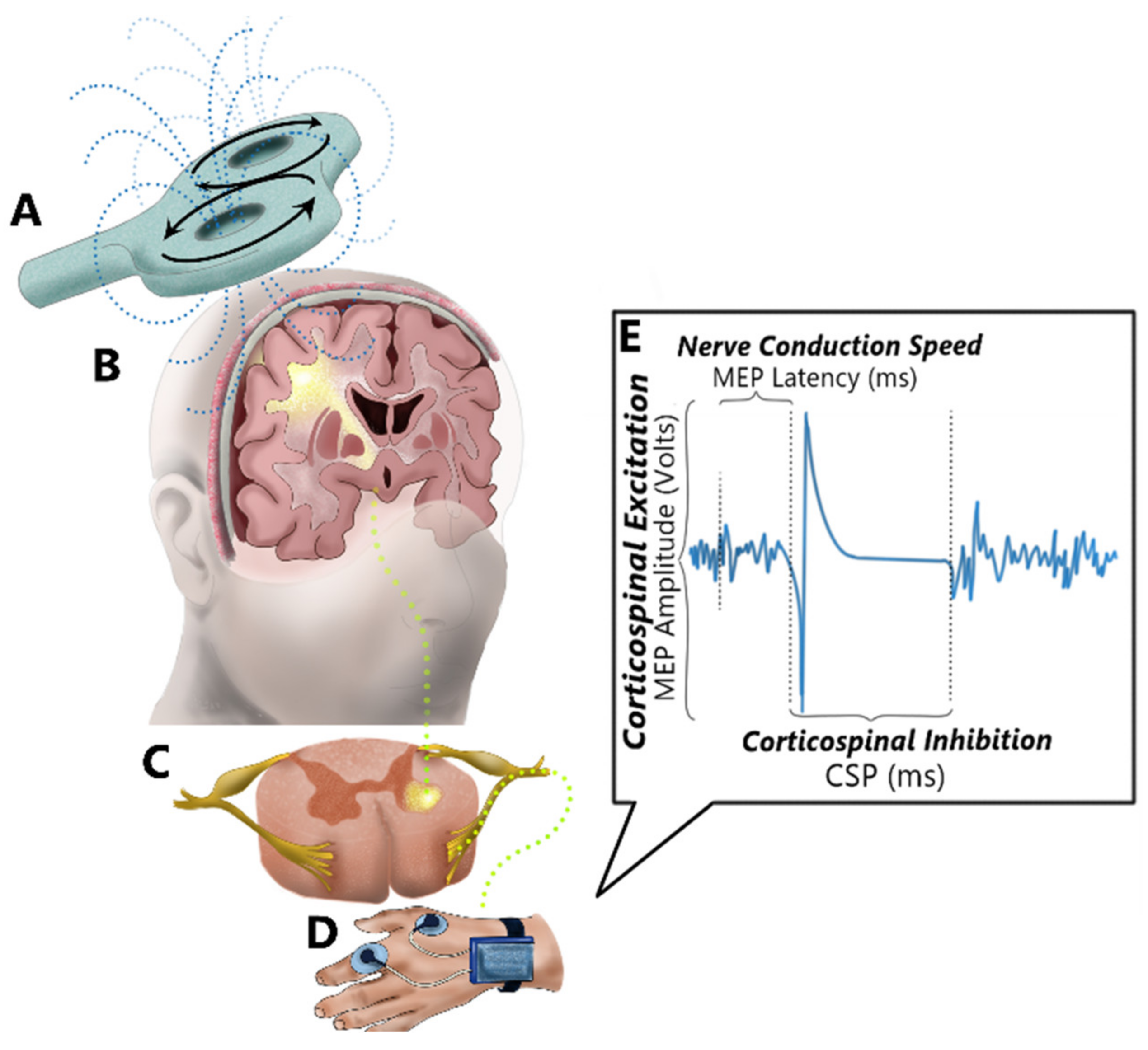 Brain Sciences | Free Full-Text | Probing the Brain–Body Connection Using Transcranial  Magnetic Stimulation (TMS): Validating a Promising Tool to Provide  Biomarkers of Neuroplasticity and Central Nervous System Function