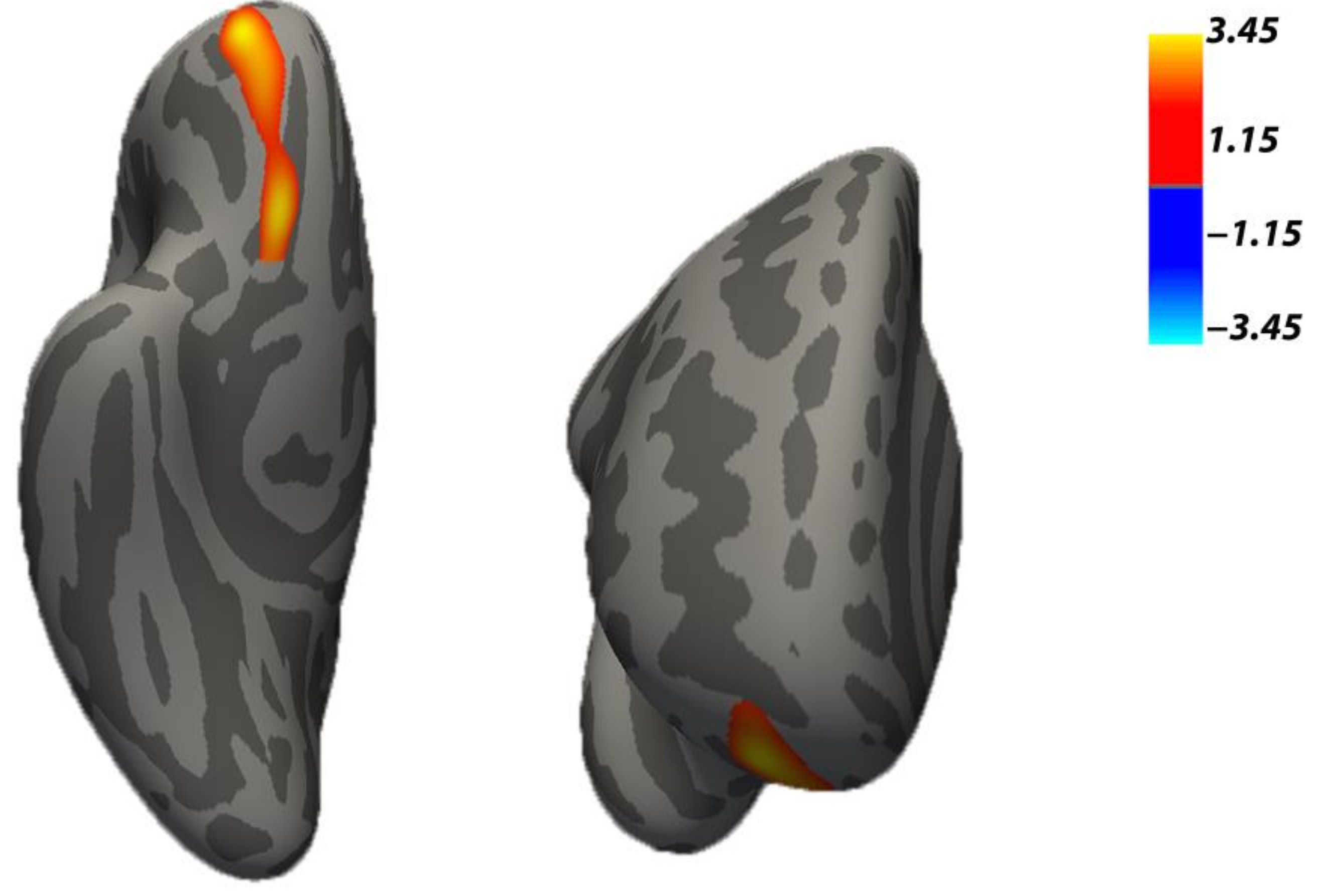 Brainsci 11 00387 g001 Brainsci 11 00387 g001