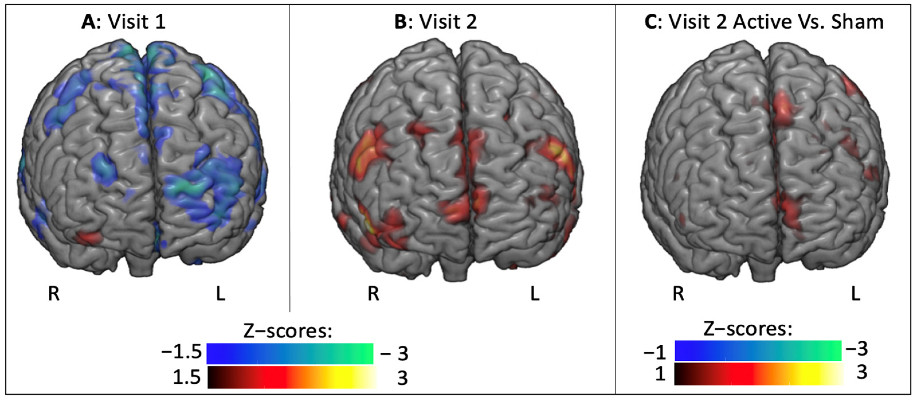 Brainsci 11 00494 g007 Brainsci 11 00494 g007