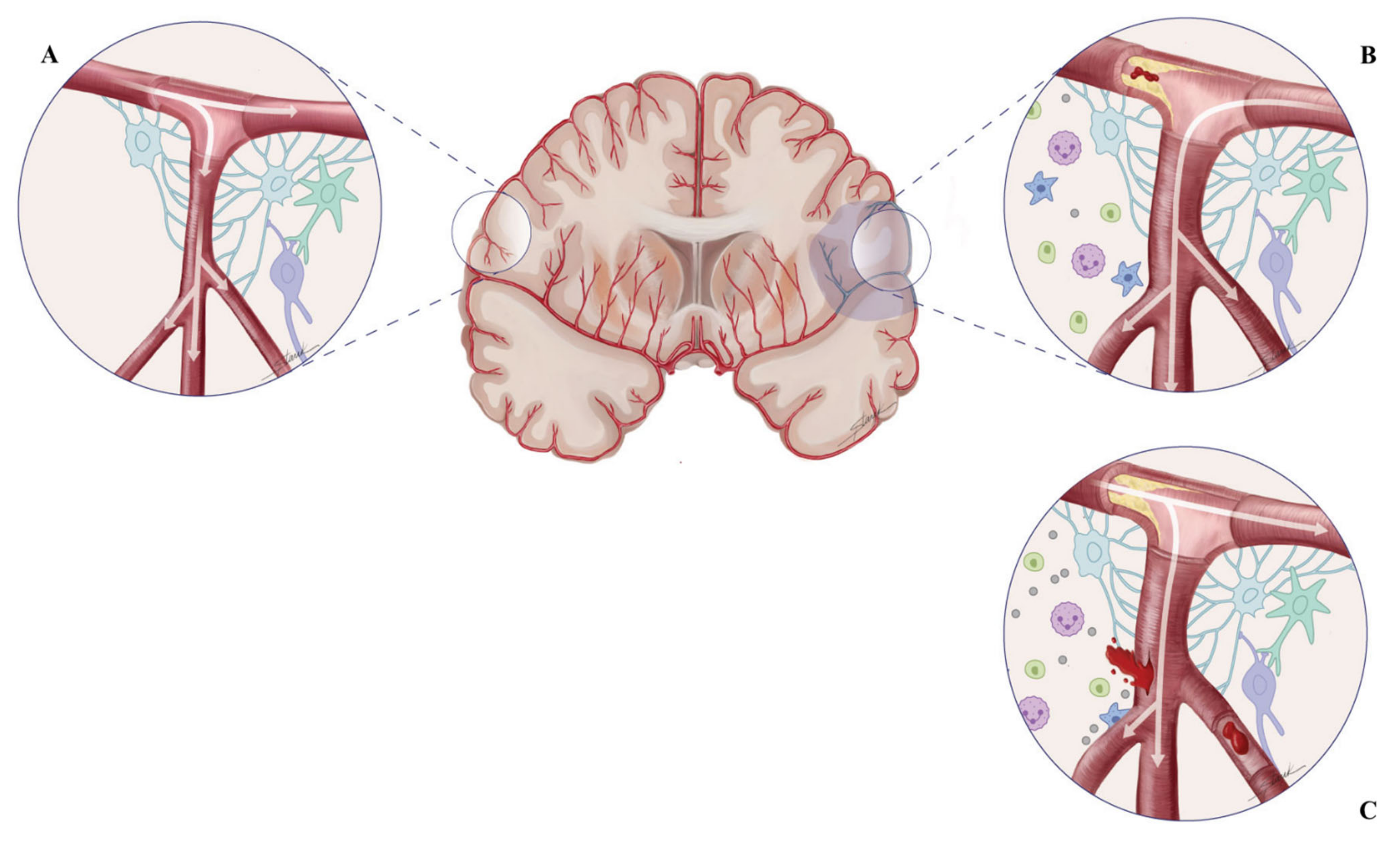 Brain Sciences Free Full Text Cerebral Autoregulation in