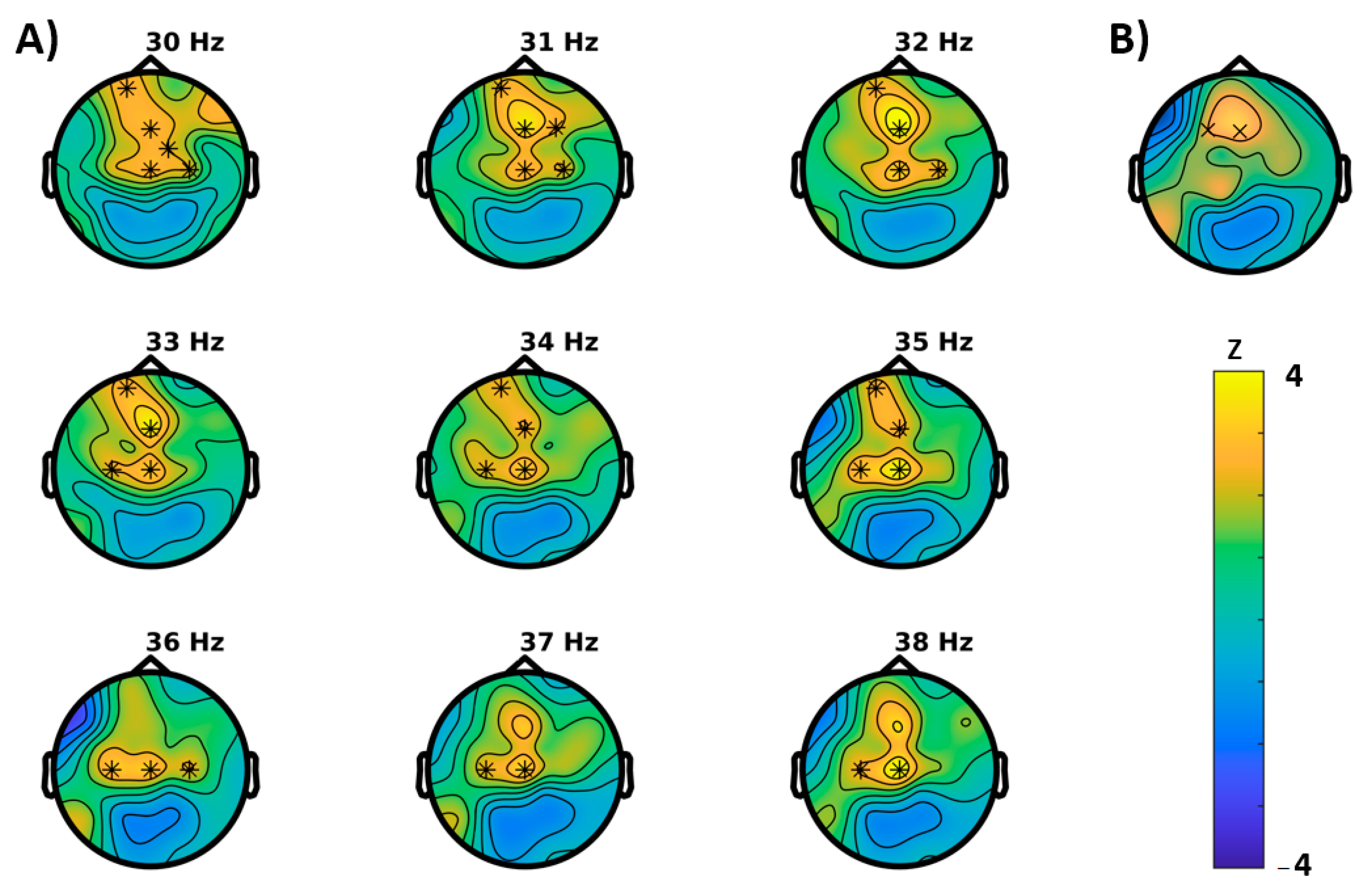 Brain Sciences Free Full Text Cognitive Effects of Montelukast