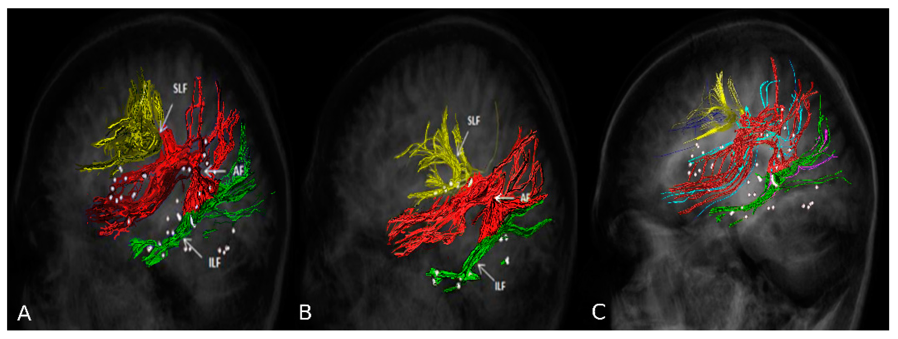 Brainsci 11 00557 g003 Brainsci 11 00557 g003