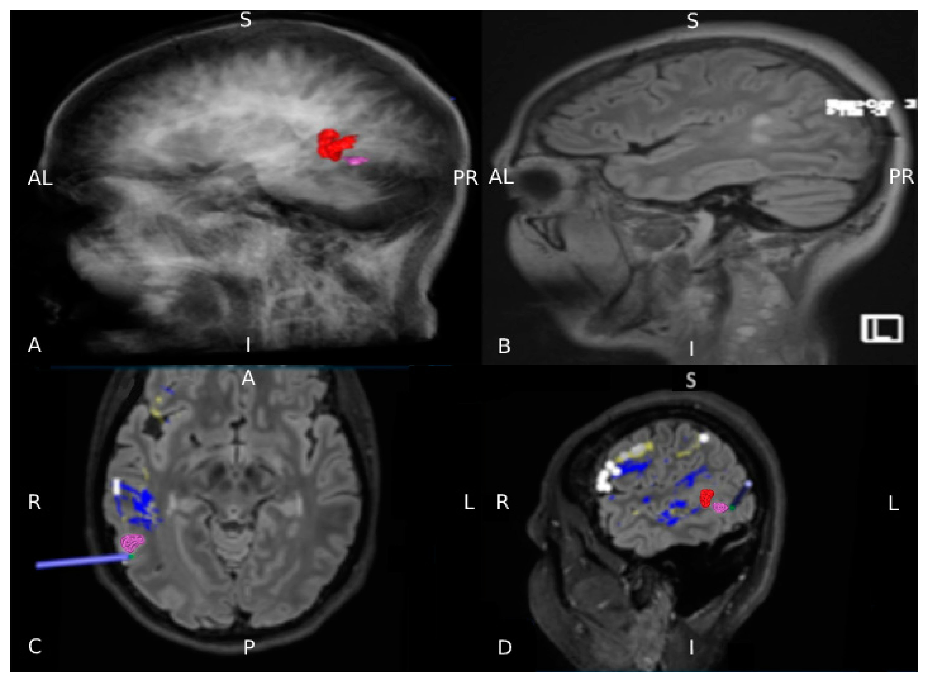 Brainsci 11 00557 g004 Brainsci 11 00557 g004
