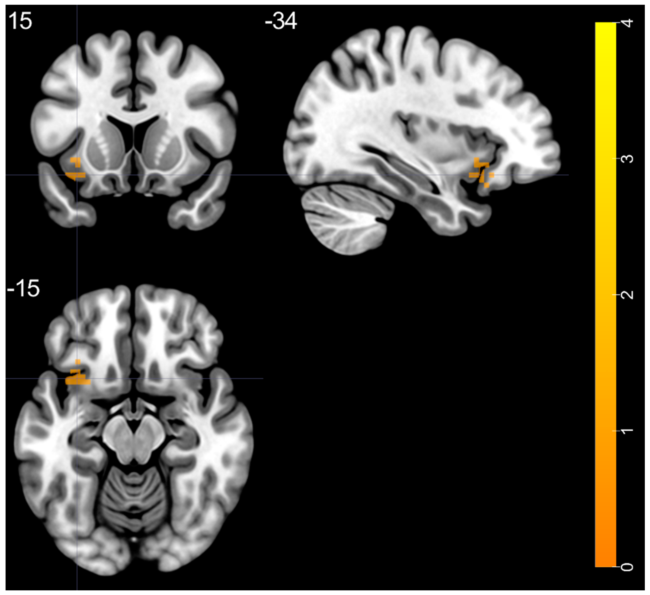 Brainsci 11 00599 g003