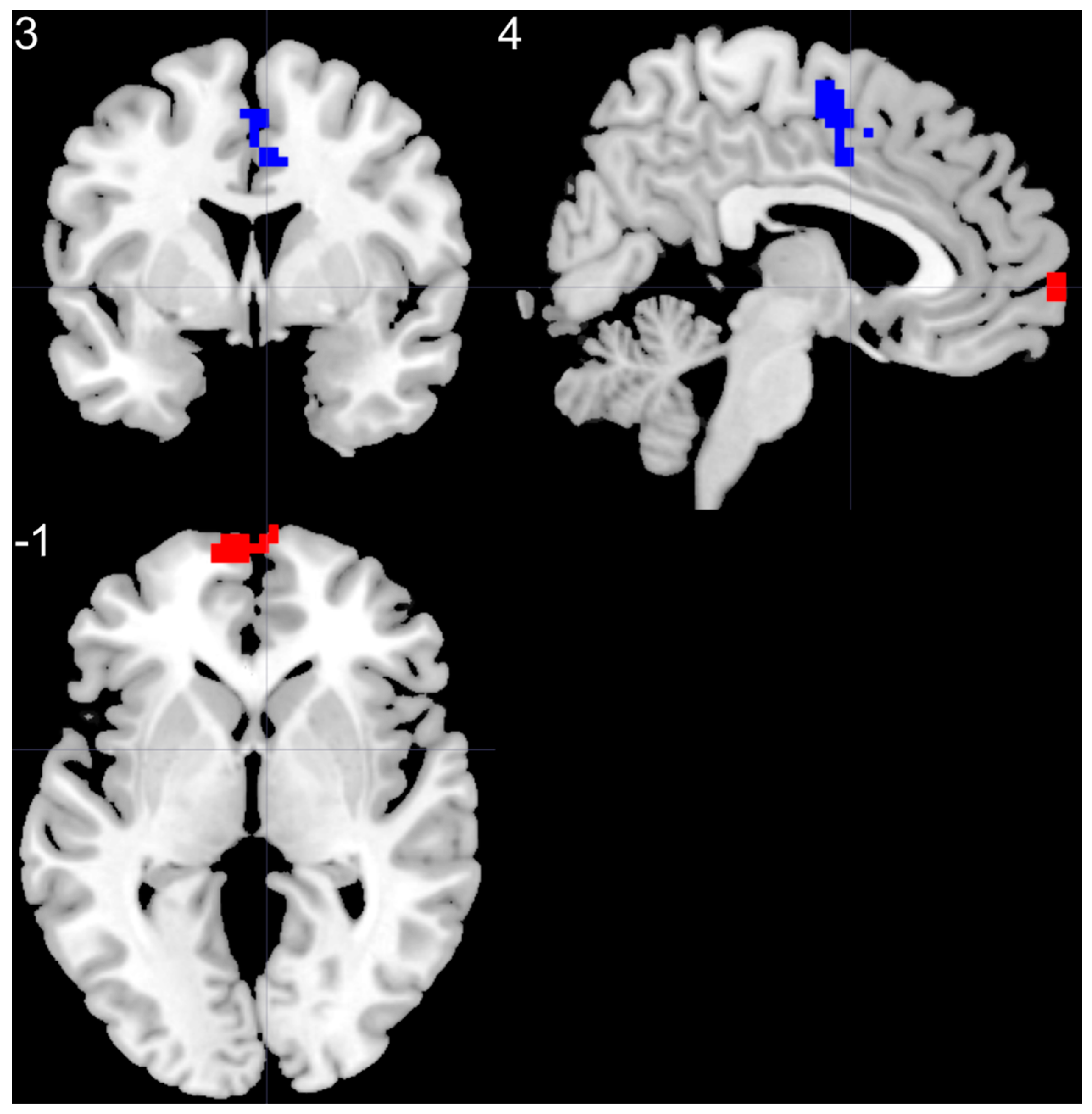Brainsci 11 00599 g006