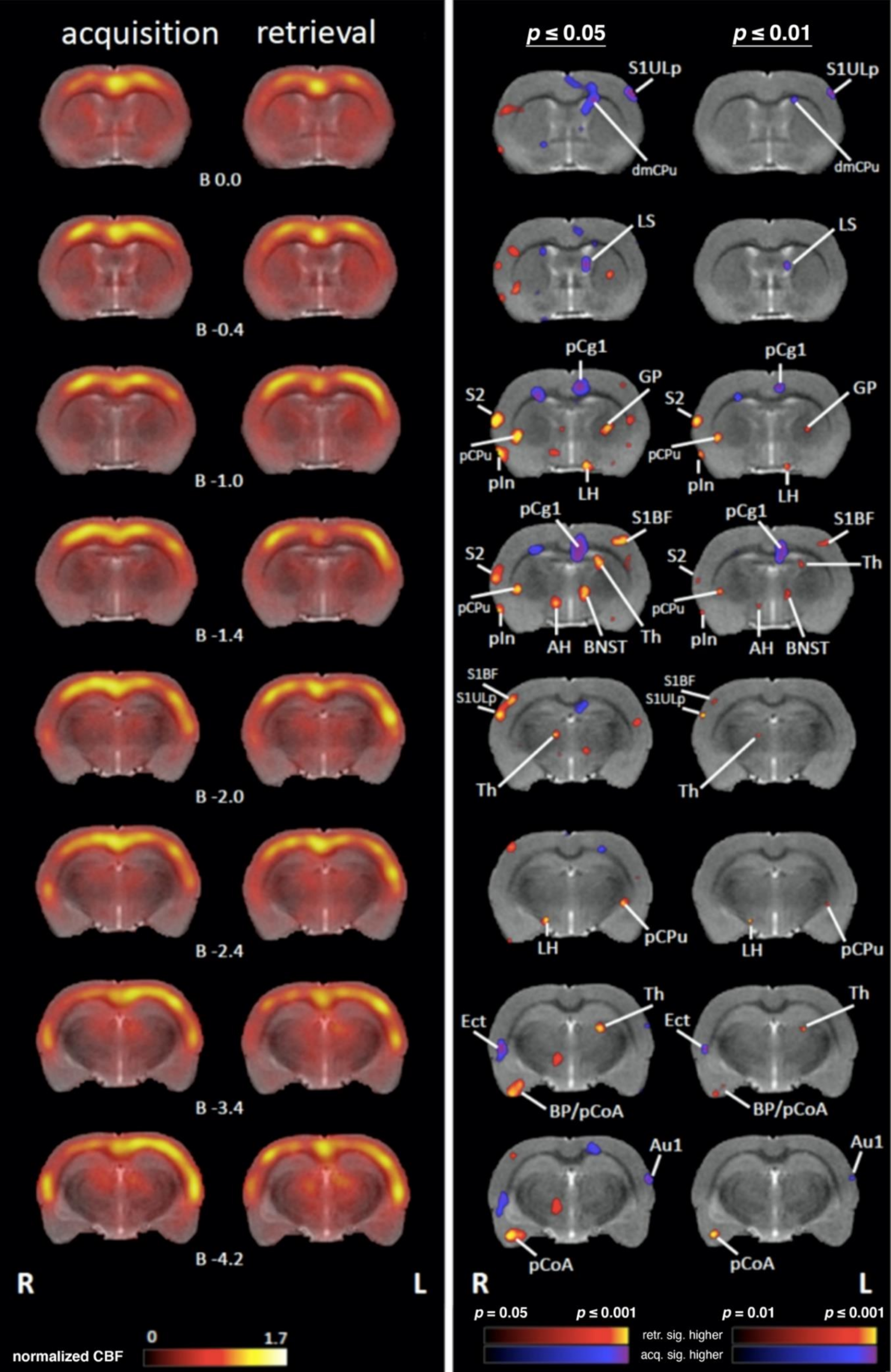 Brain Sciences Free Full Text Imaging Of Functional Brain Circuits During Acquisition And Memory Retrieval In An Aversive Feedback Learning Task Single Photon Emission Computed Tomography Of Regional Cerebral Blood Flow