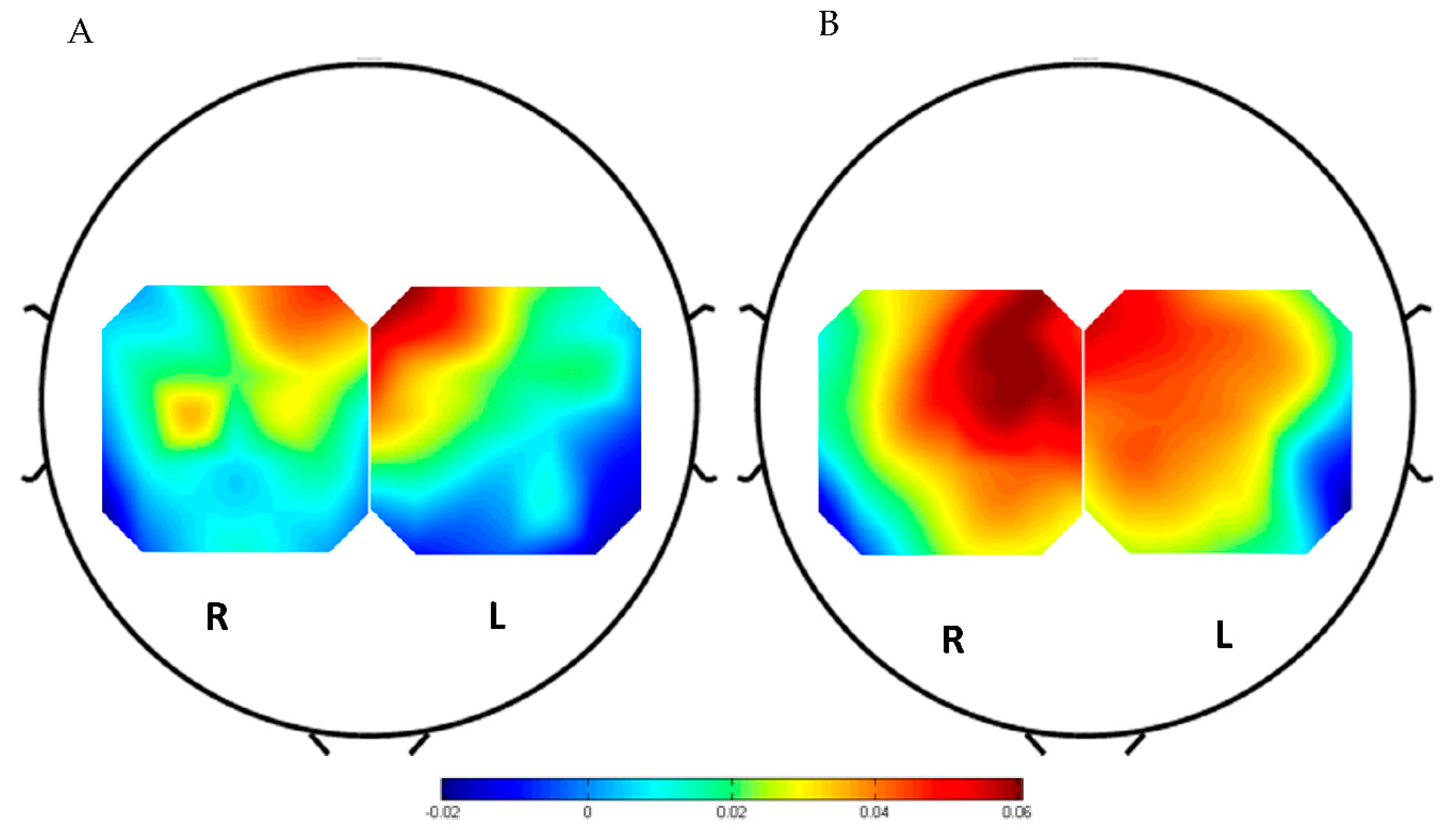 Brainsci 11 00713 g005