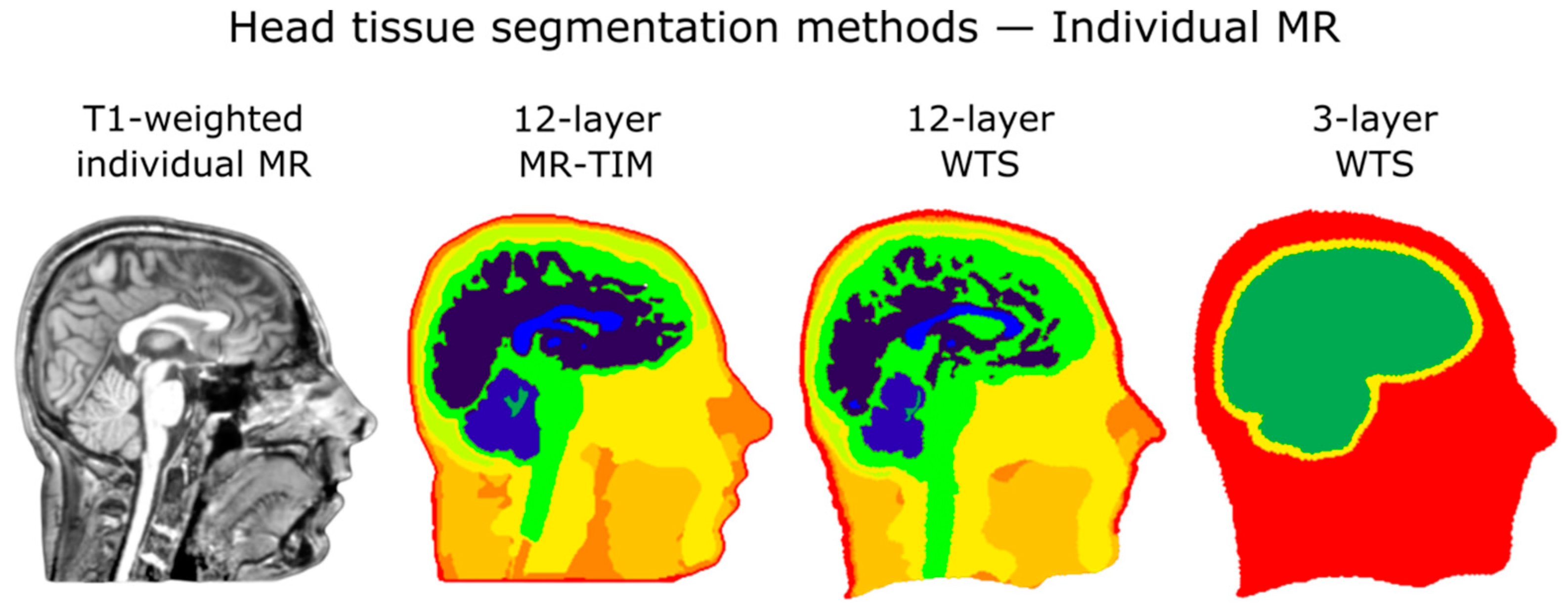 Brainsci 11 00741 g003