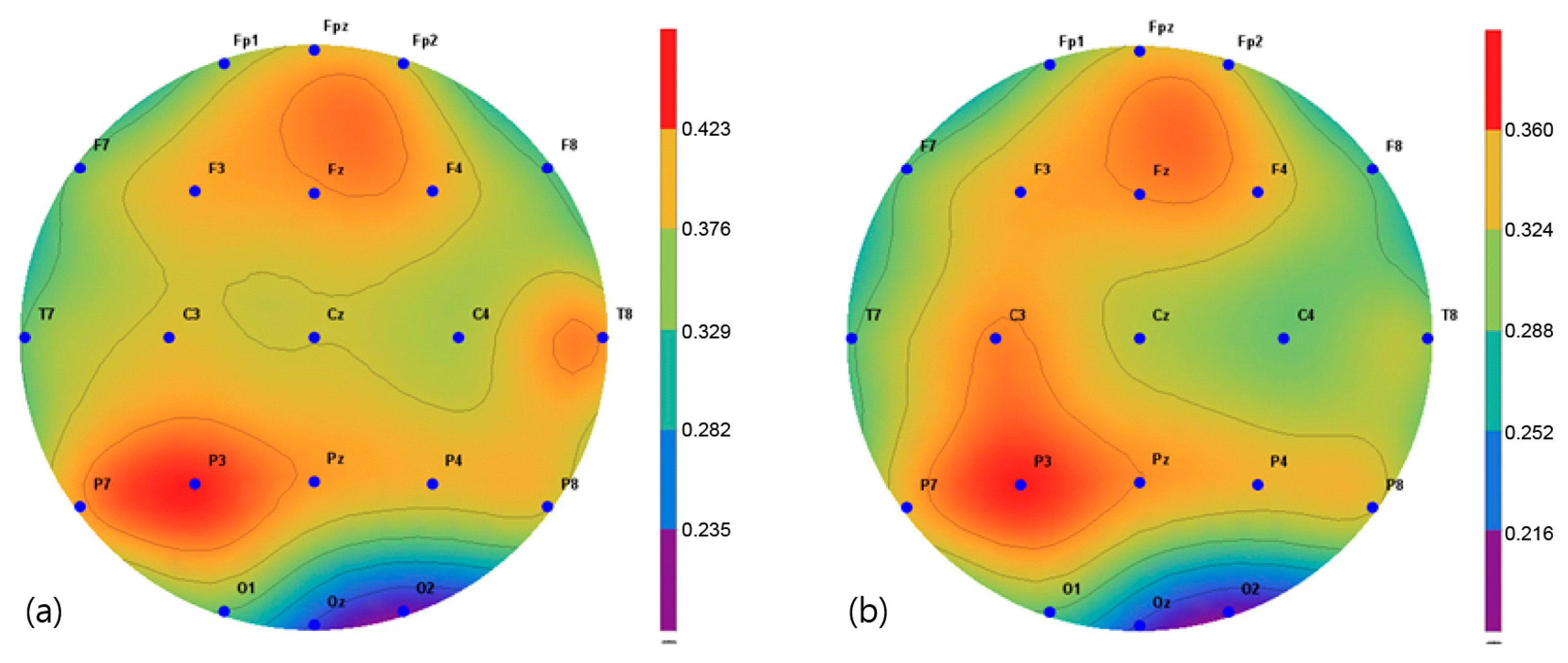 Brainsci 11 01032 g008 Brainsci 11 01032 g008