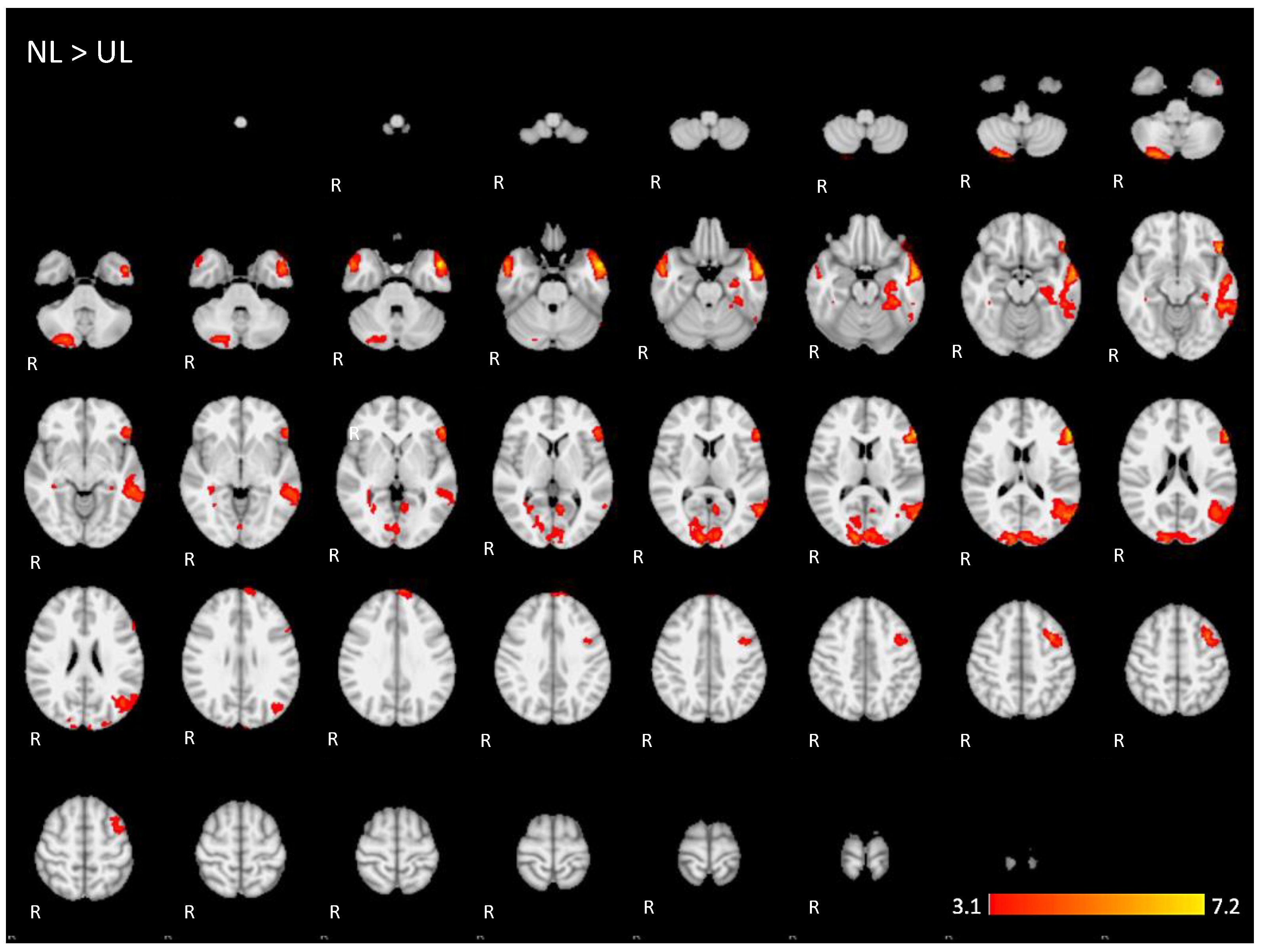 Brainsci 11 01063 g0a3