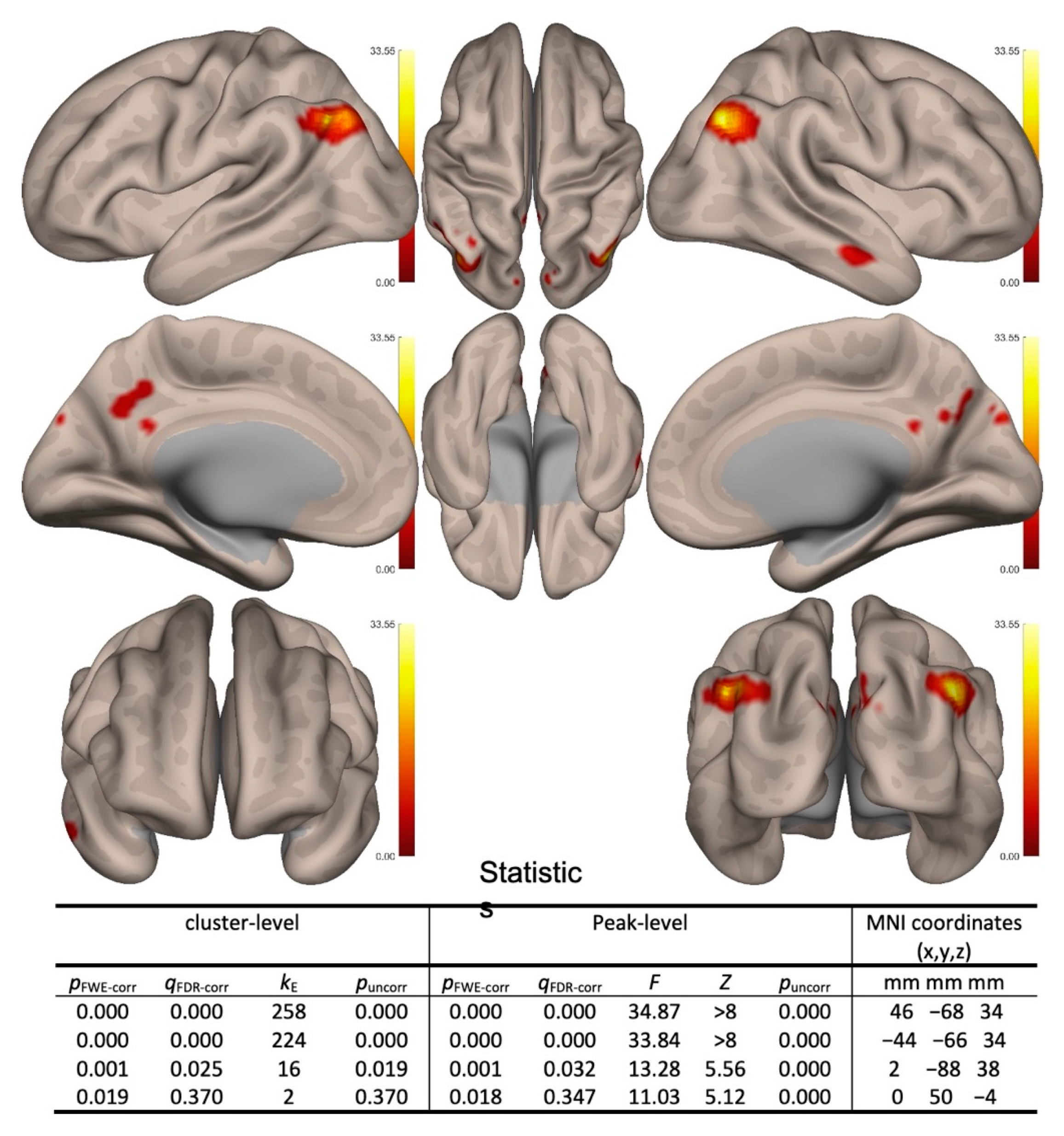 fransson human brain mapping 2005