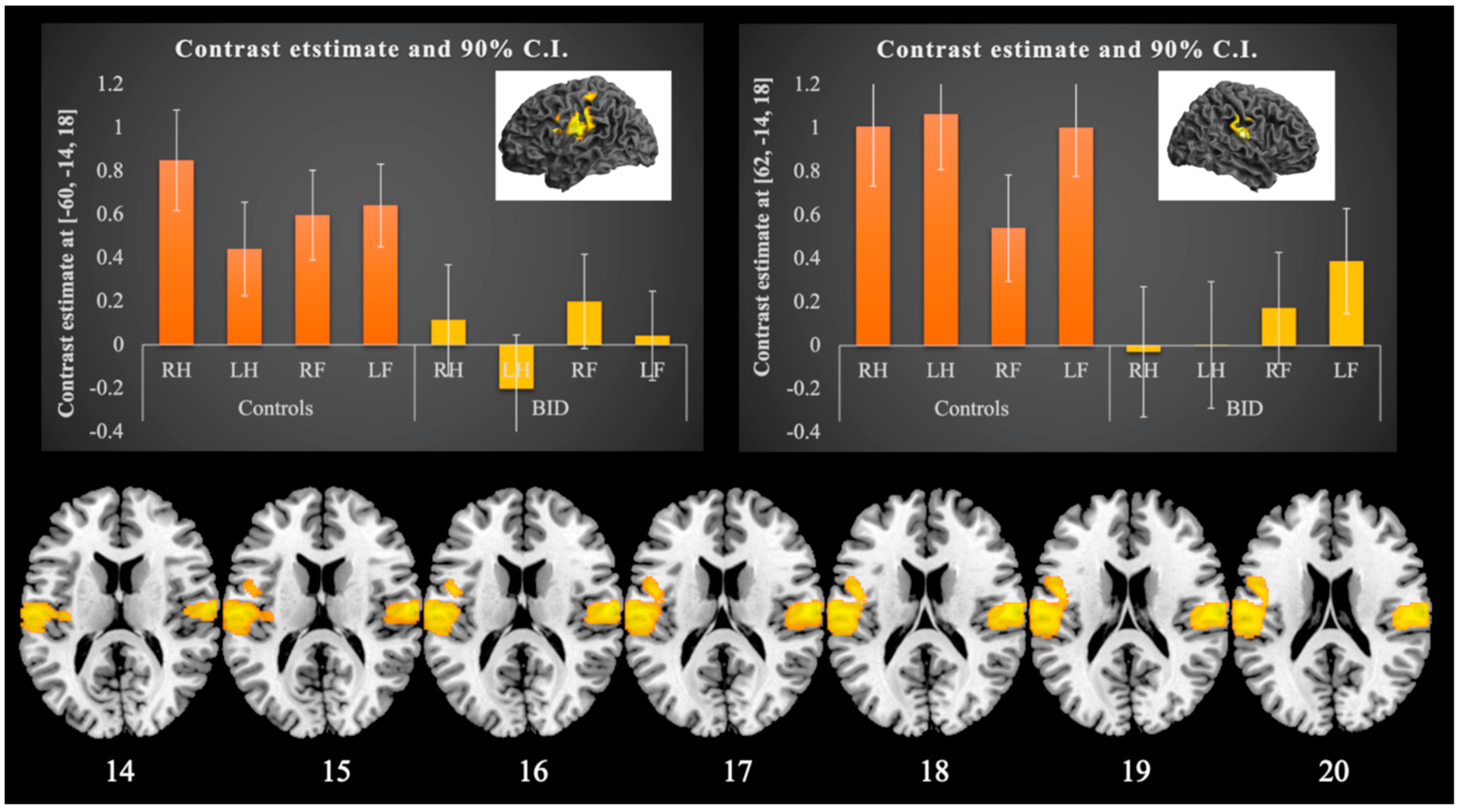 Brain Sciences | Free Full-Text | Brain Abnormalities in