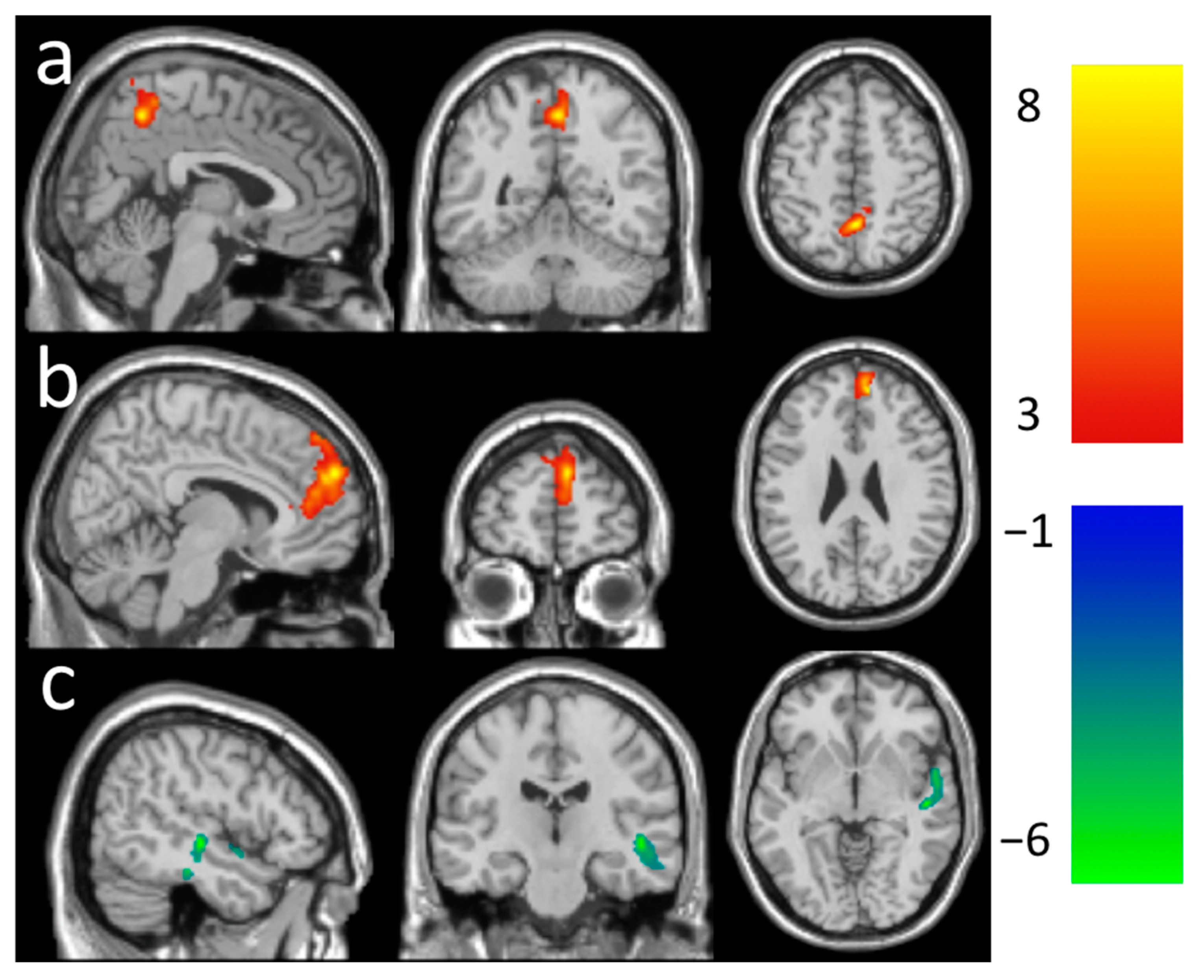 Brain Sciences Free Full Text The Longitudinal Effect Of Meditation On Resting State Functional Connectivity Using Dynamic Arterial Spin Labeling A Feasibility Study Html