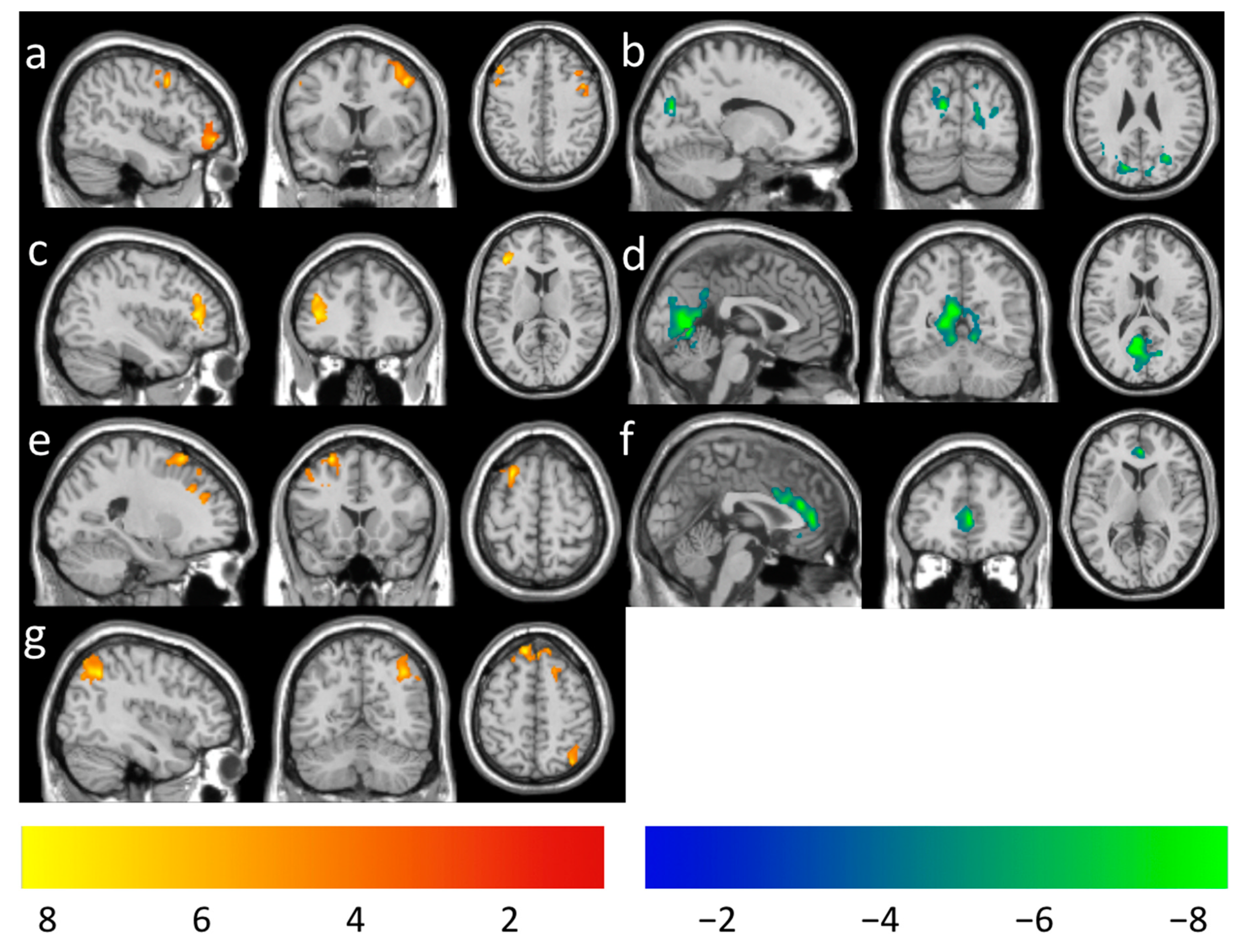 Brain Sciences Free Full Text The Longitudinal Effect Of Meditation On Resting State Functional Connectivity Using Dynamic Arterial Spin Labeling A Feasibility Study Html