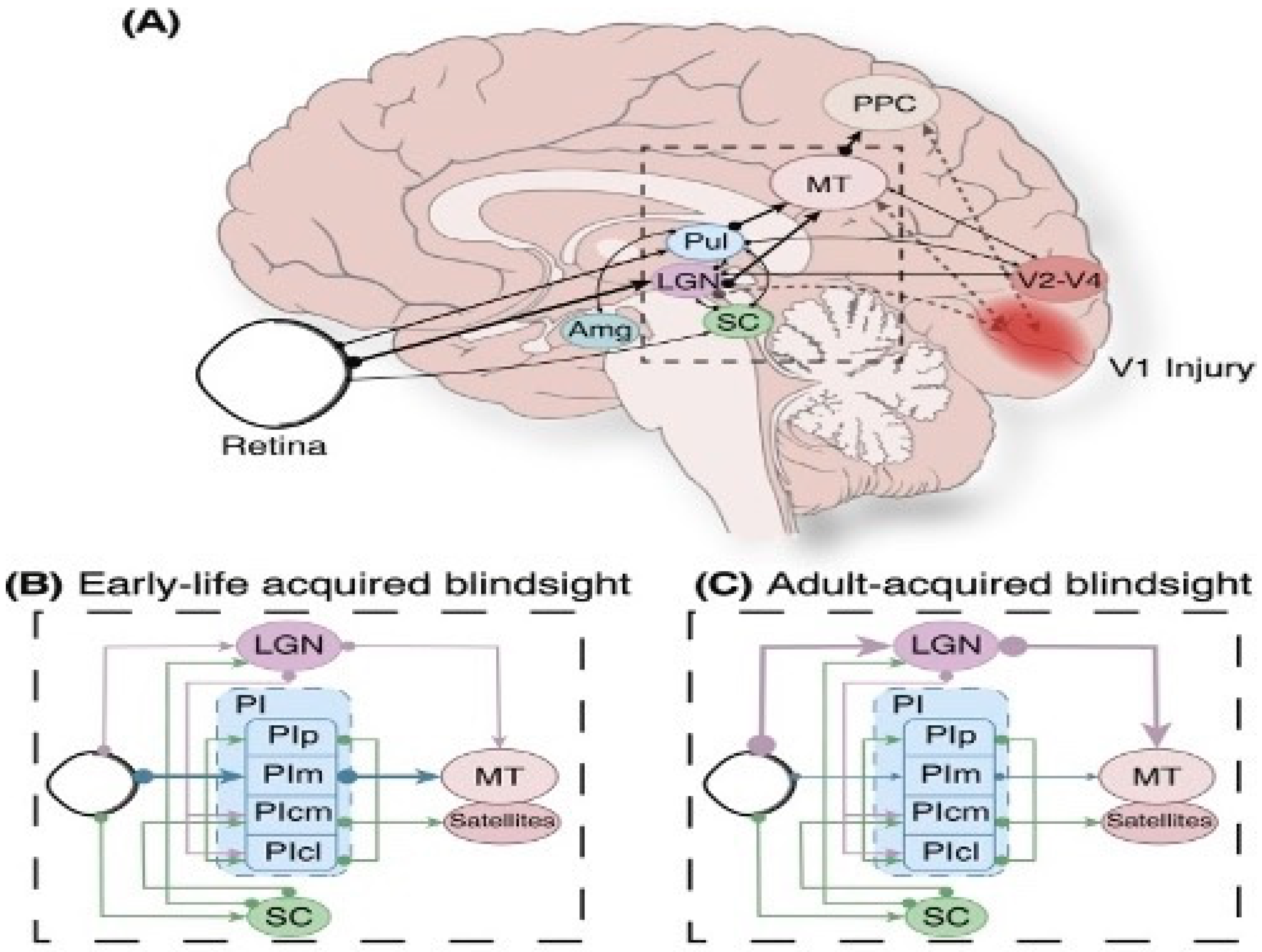 Blind people's brains rewire themselves to track moving objects by sound,  study finds