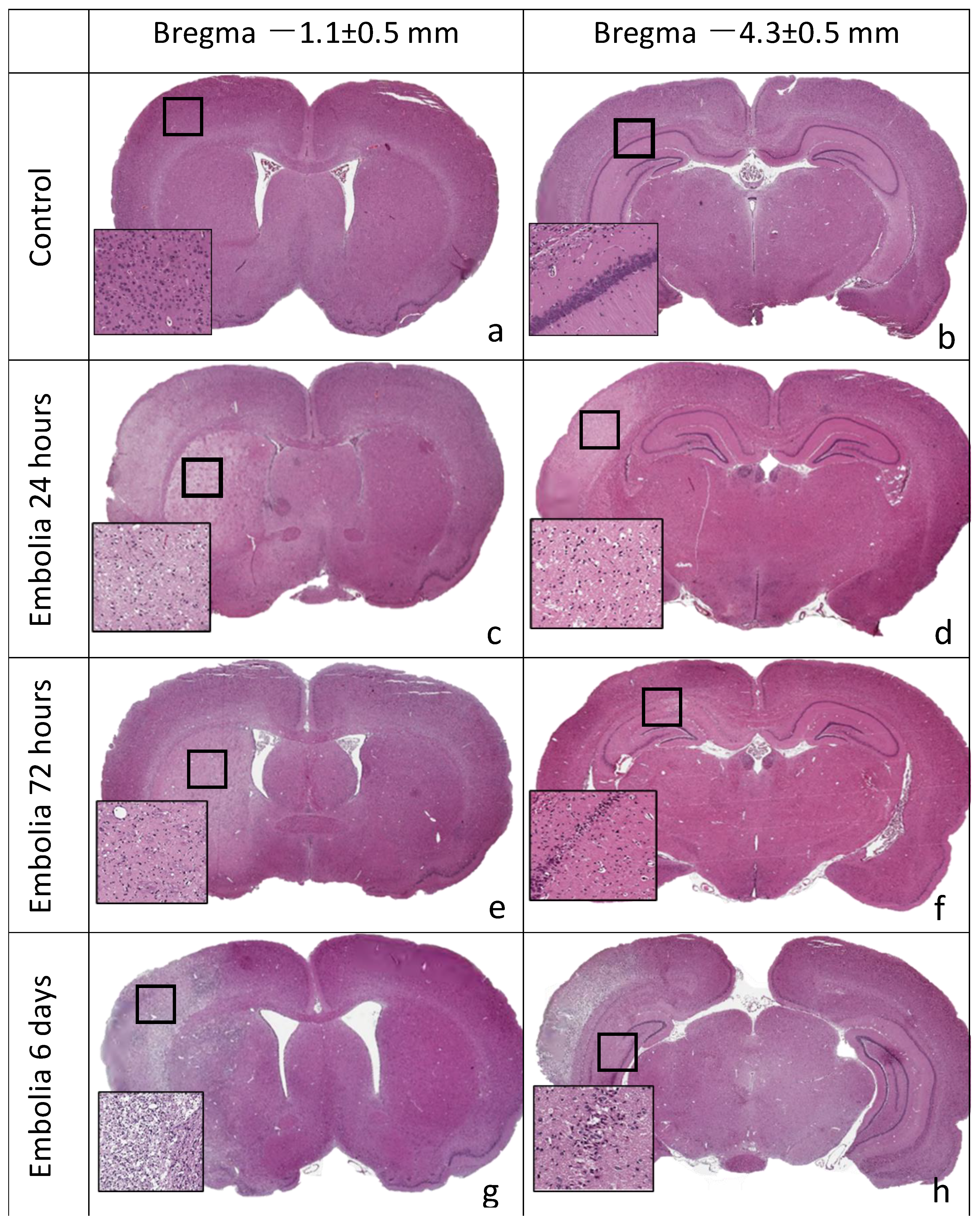 Brainsci 11 01475 g004 Brainsci 11 01475 g004